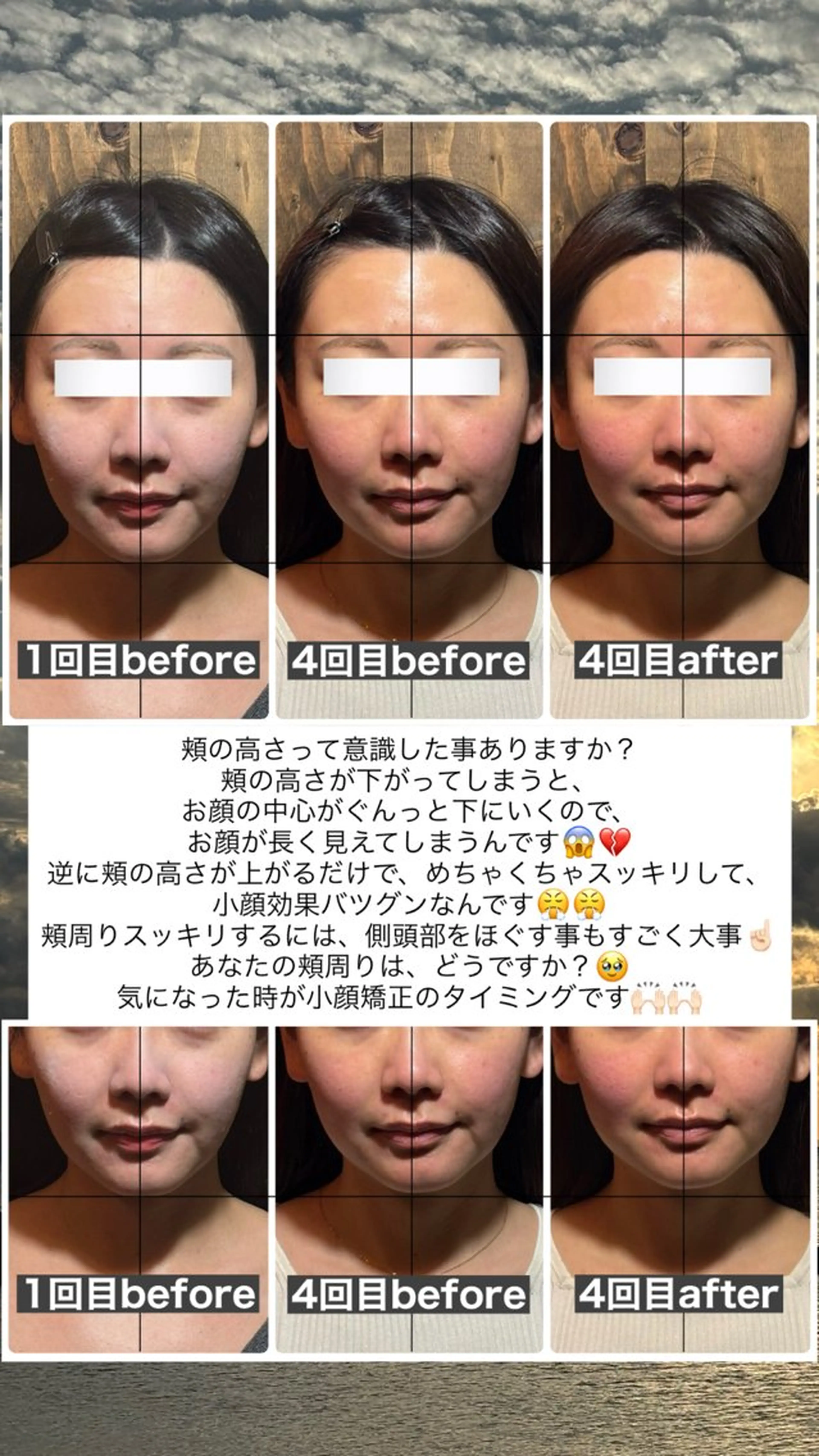 エステ リラク 💎後悔させない小顔 矯正💎イトヤマ🌱のエステ・リラクイメージ