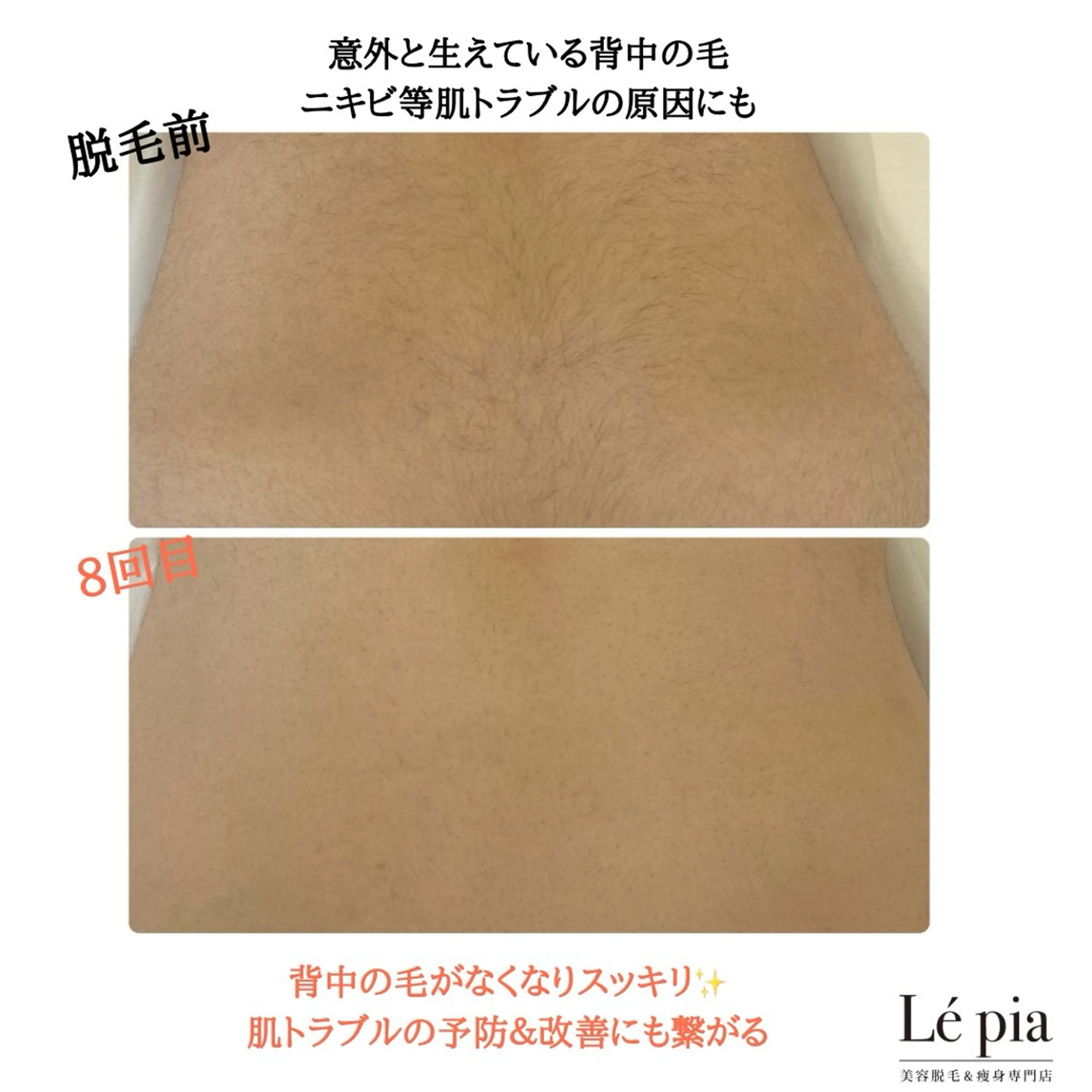 脱毛 美容脱毛専門店 Lé pia レピアのエステ・リラクイメージ