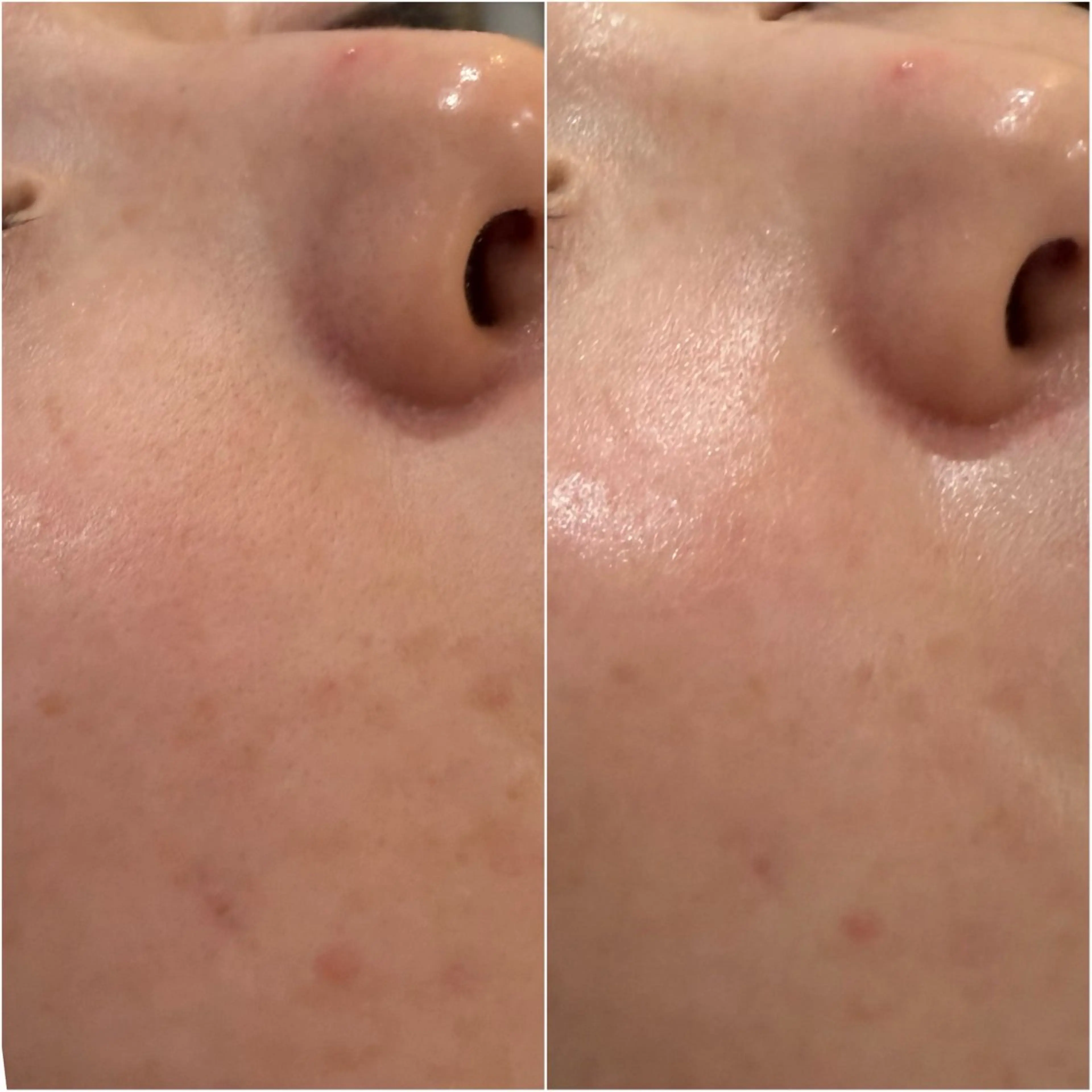 顔脱毛×エステサロン BLOOMi.の眉毛・アイブロウイメージ