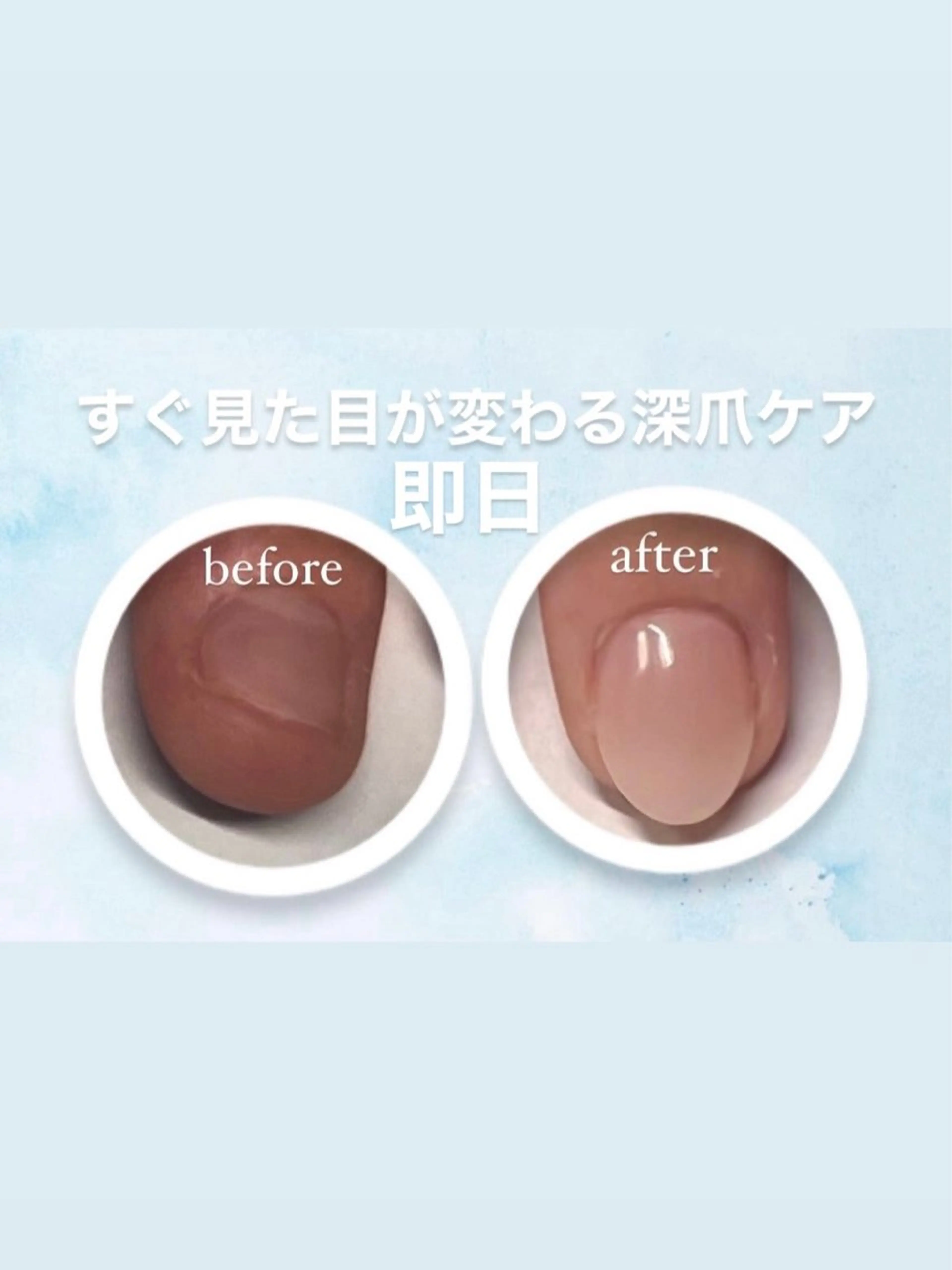 メンズ ネイル ハンドネイル 爪ケア/深爪 自爪育成 🐰えむのネイルデザイン