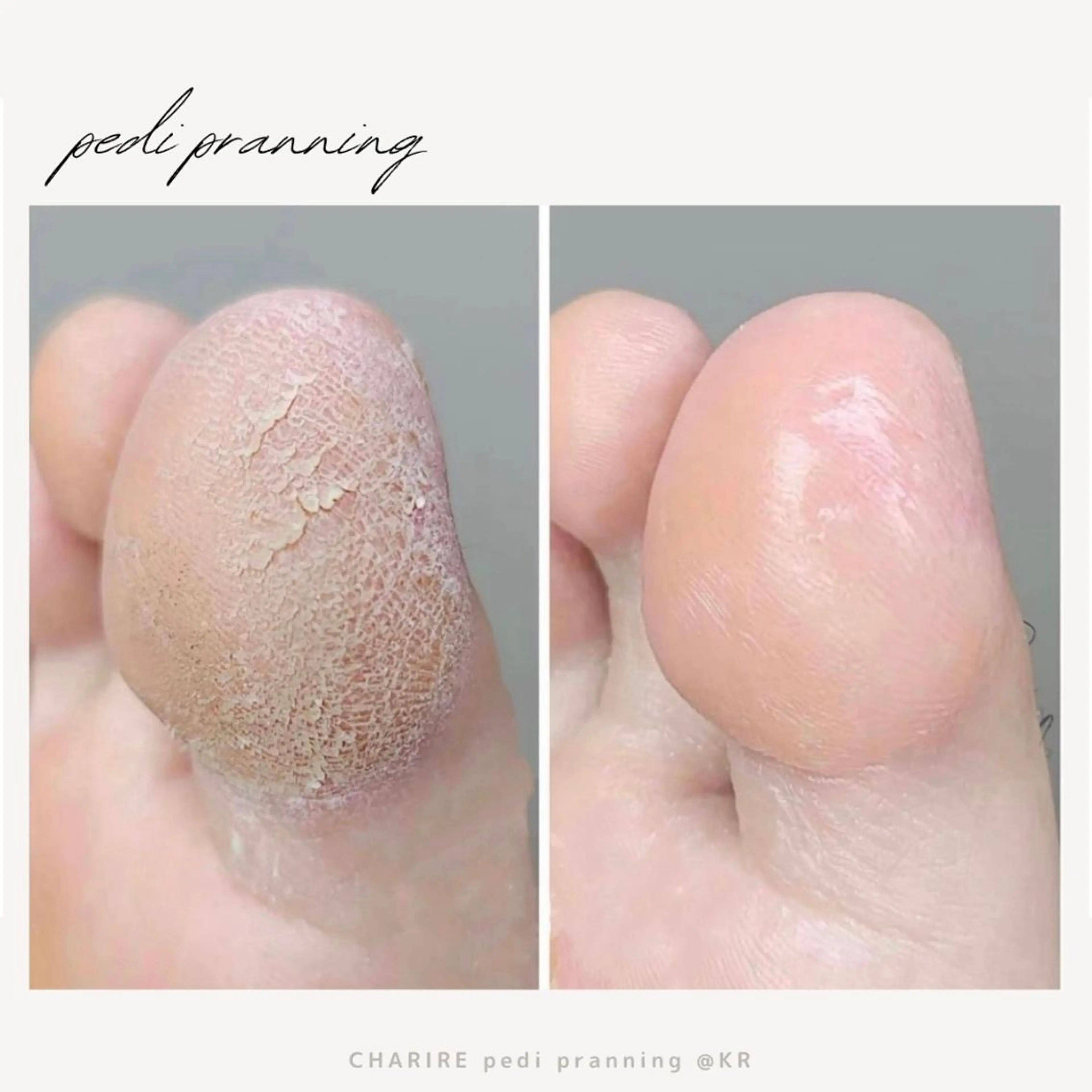 ネイル 韓国ネイル CHARIRE chinatsuのマツエク・マツパデザイン