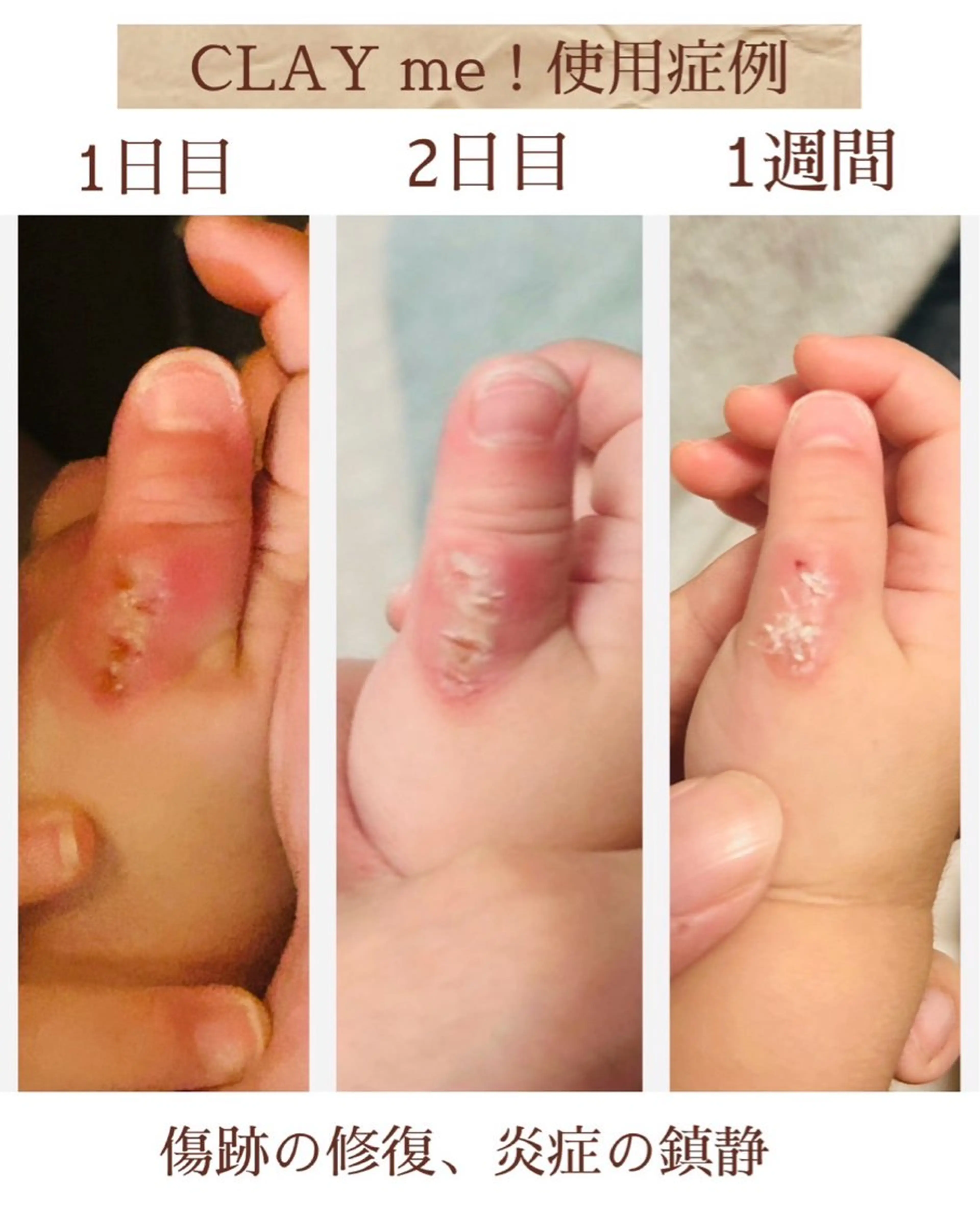 脱毛サロン MiELのエステ・リラクイメージ