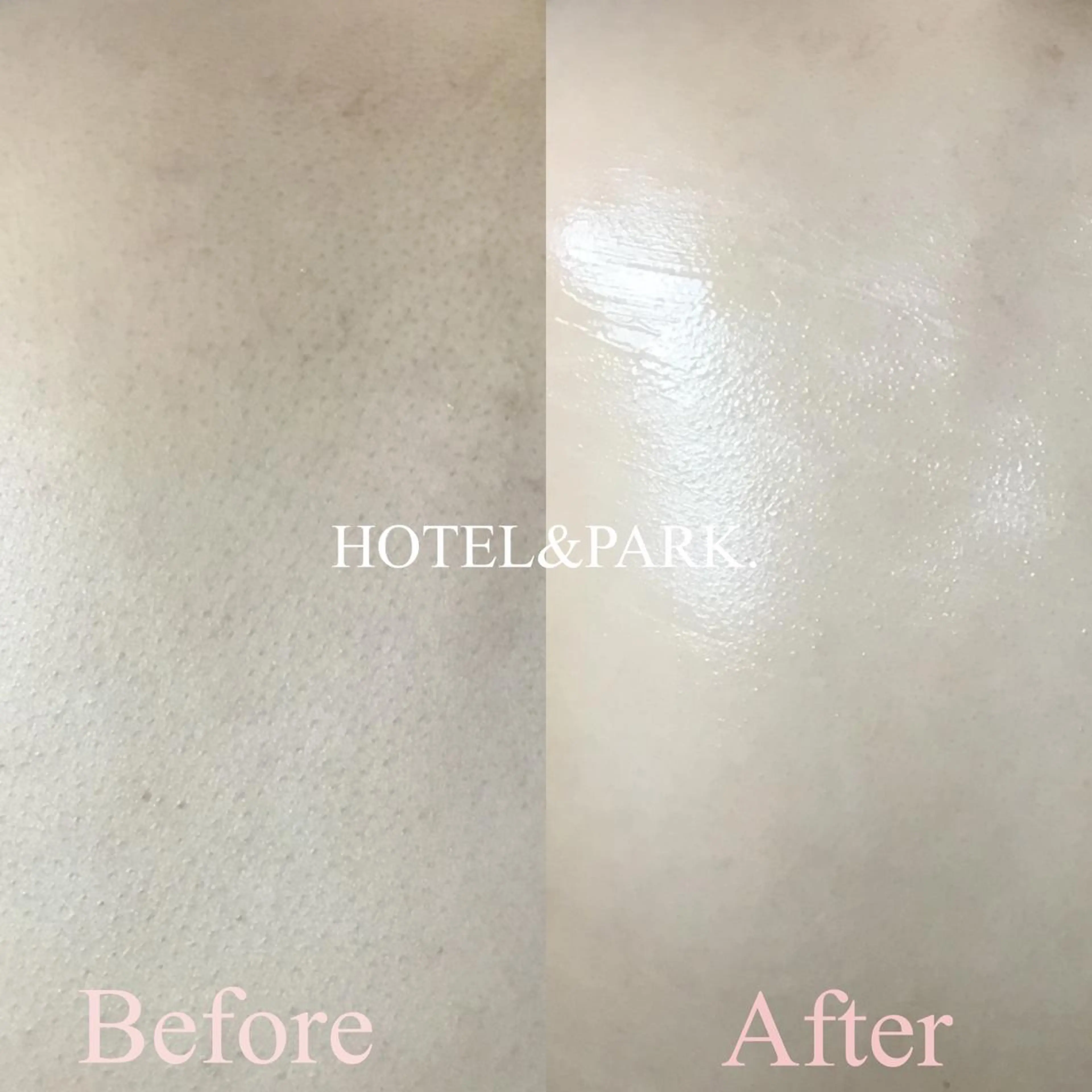 HOTEL&PARK . ワックス脱毛のエステ・リラクイメージ