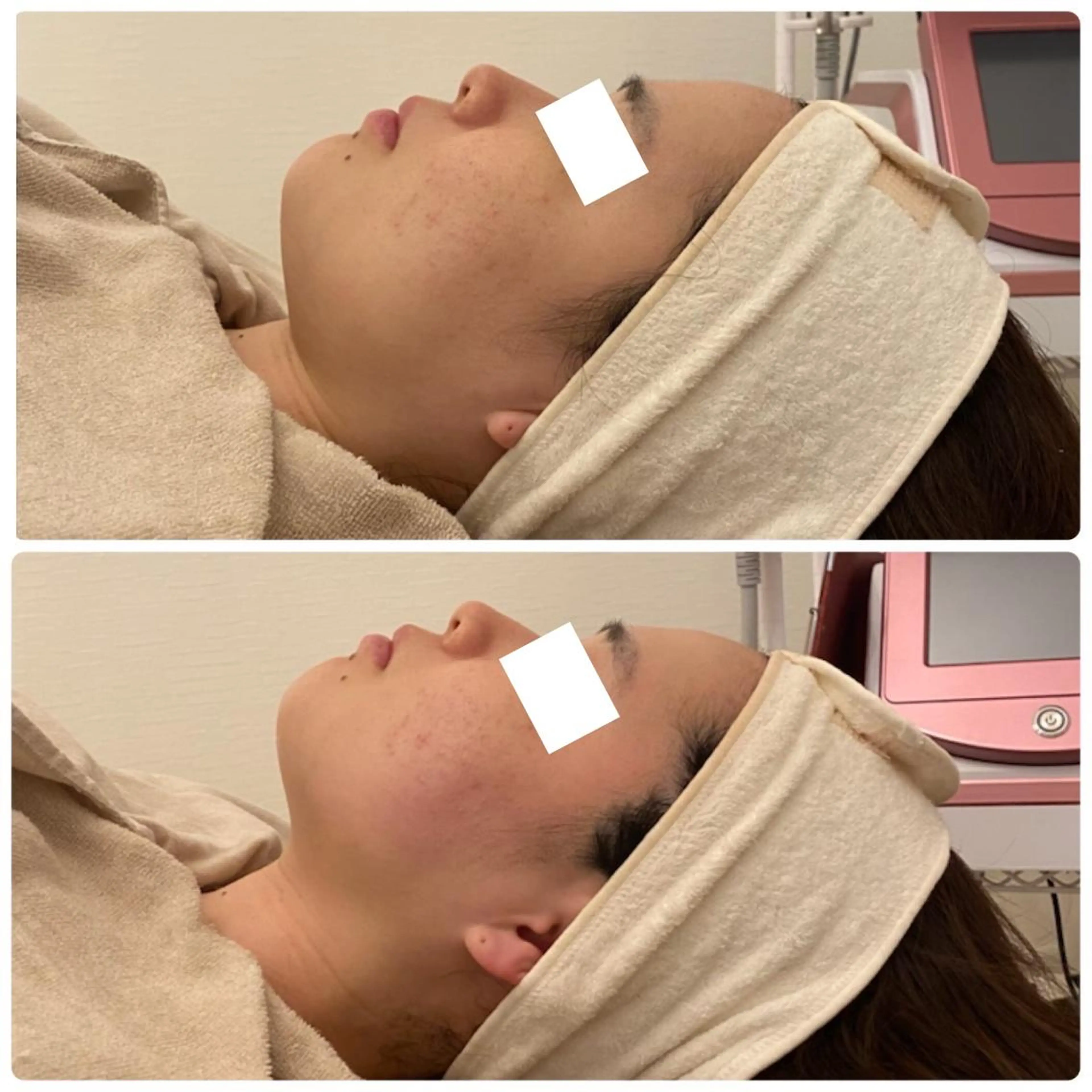 エステ ララ/ハーブ メゾンリュバンのエステ・リラクイメージ