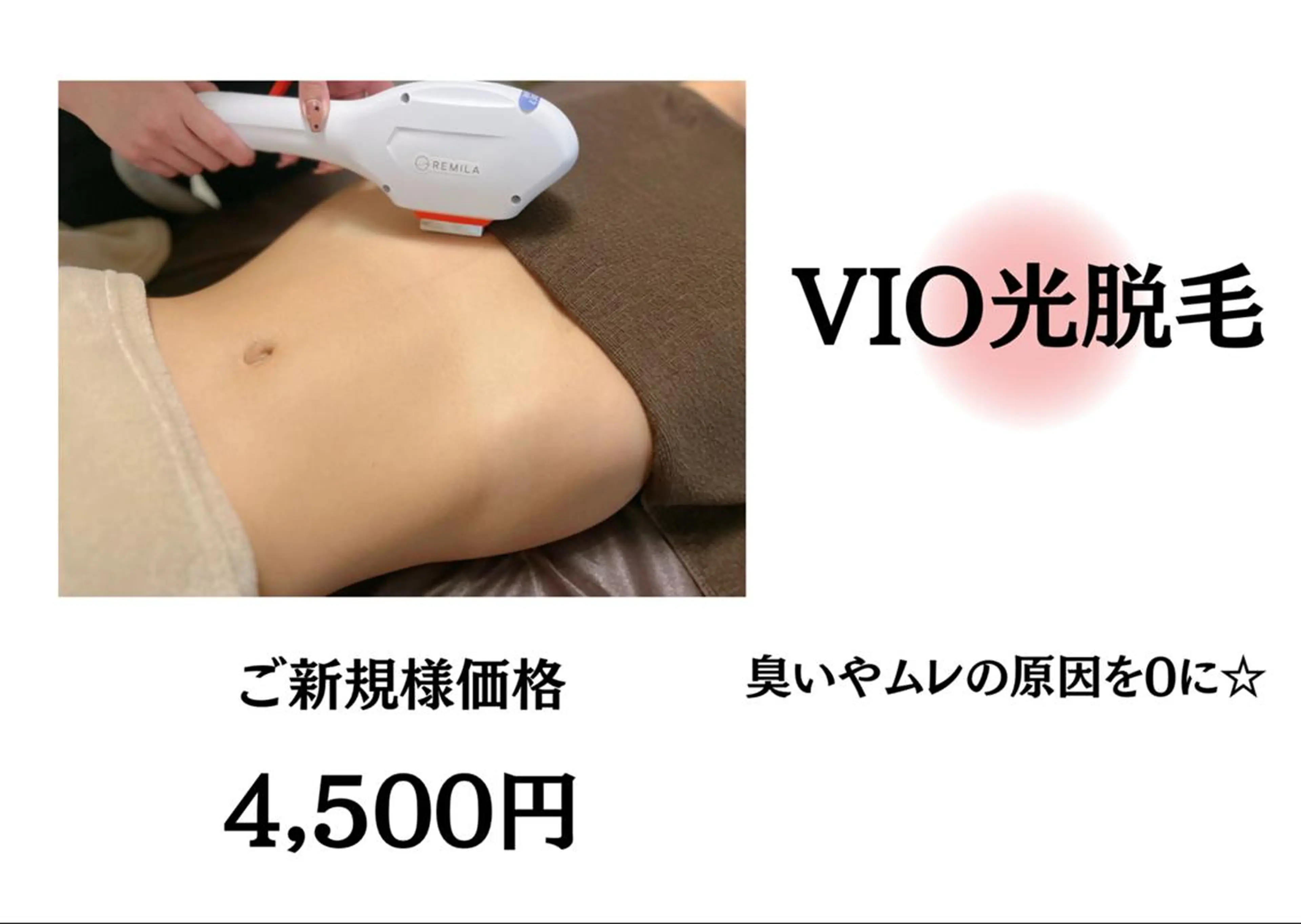 【VIO光脱毛】（黒ずみ改善）￥10000→￥4500の写真