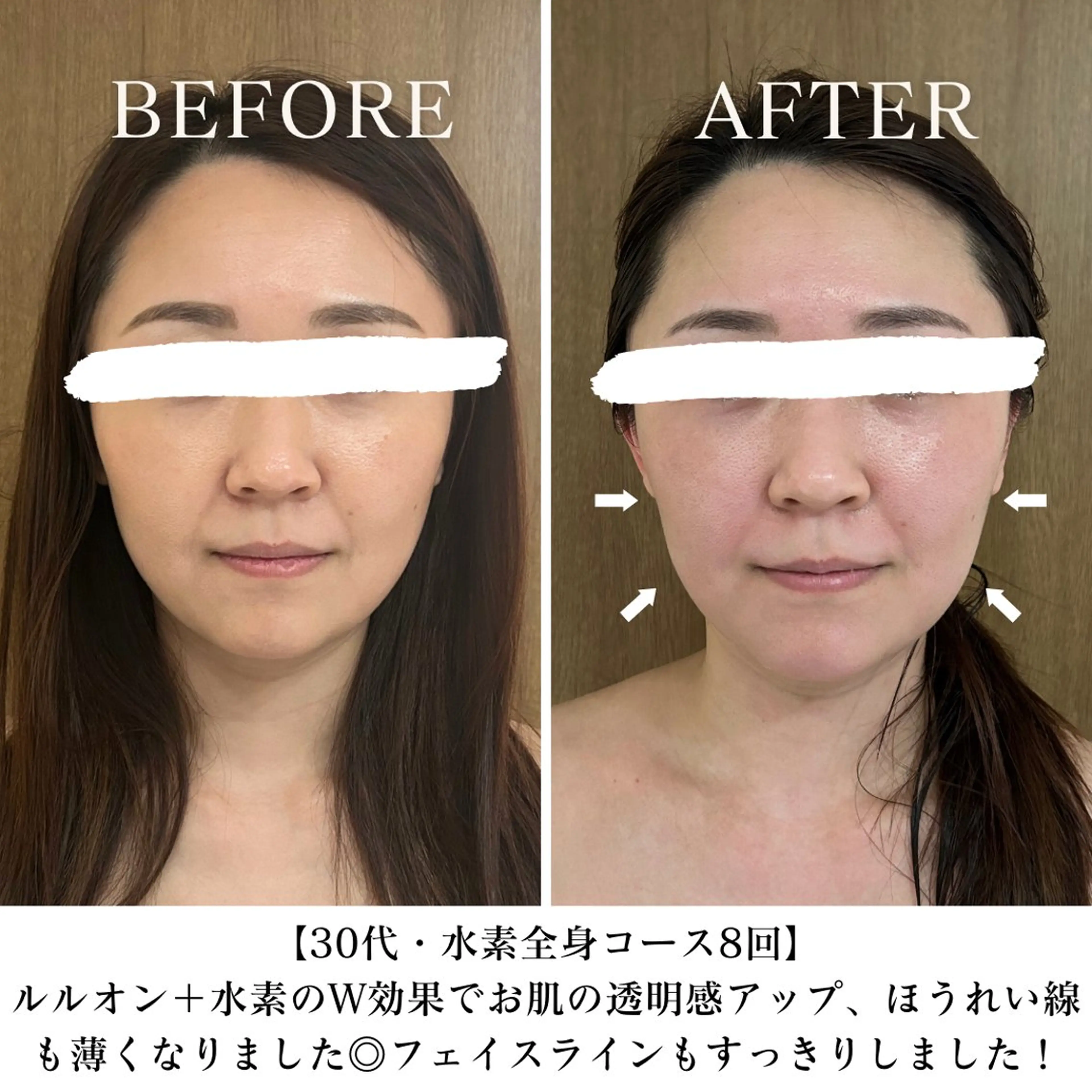 【目黒】本格痩身✴︎ 最新型よもぎ蒸しのエステ・リラクイメージ