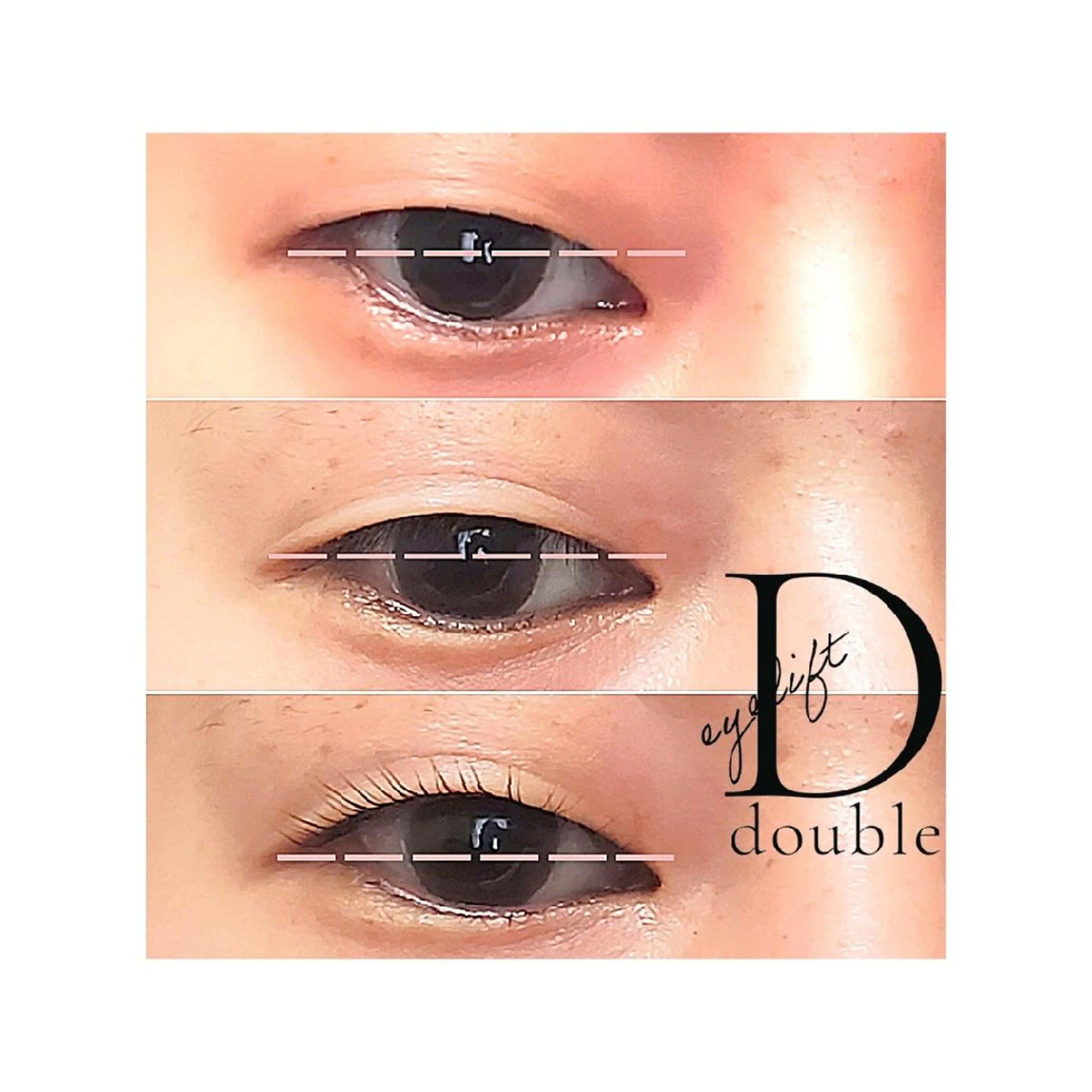 マツエク・マツパ  毛穴洗浄・まつ毛 の専門店 ソラーレのエステ・リラクイメージ