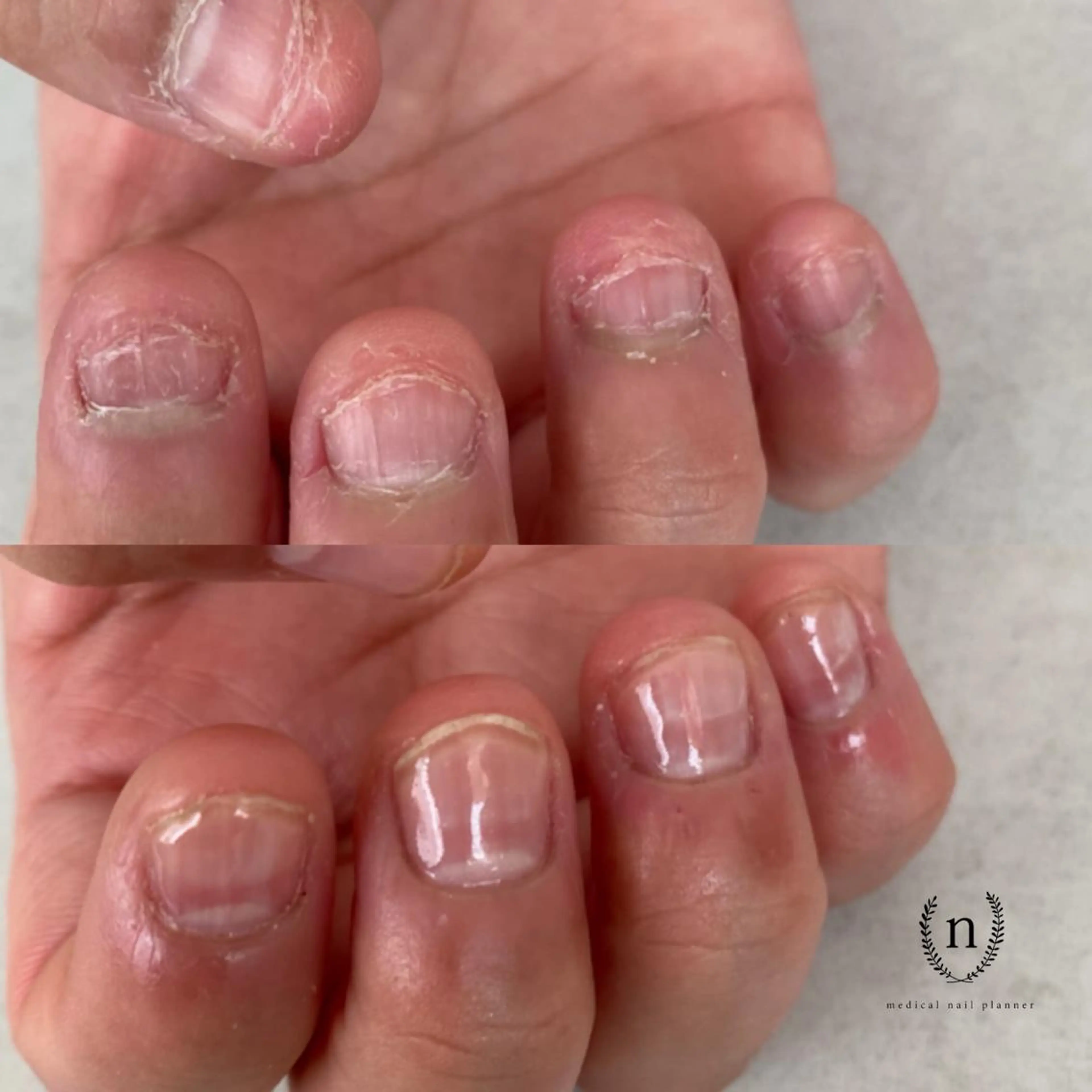 ネイル Rio 𓍼のネイルデザイン