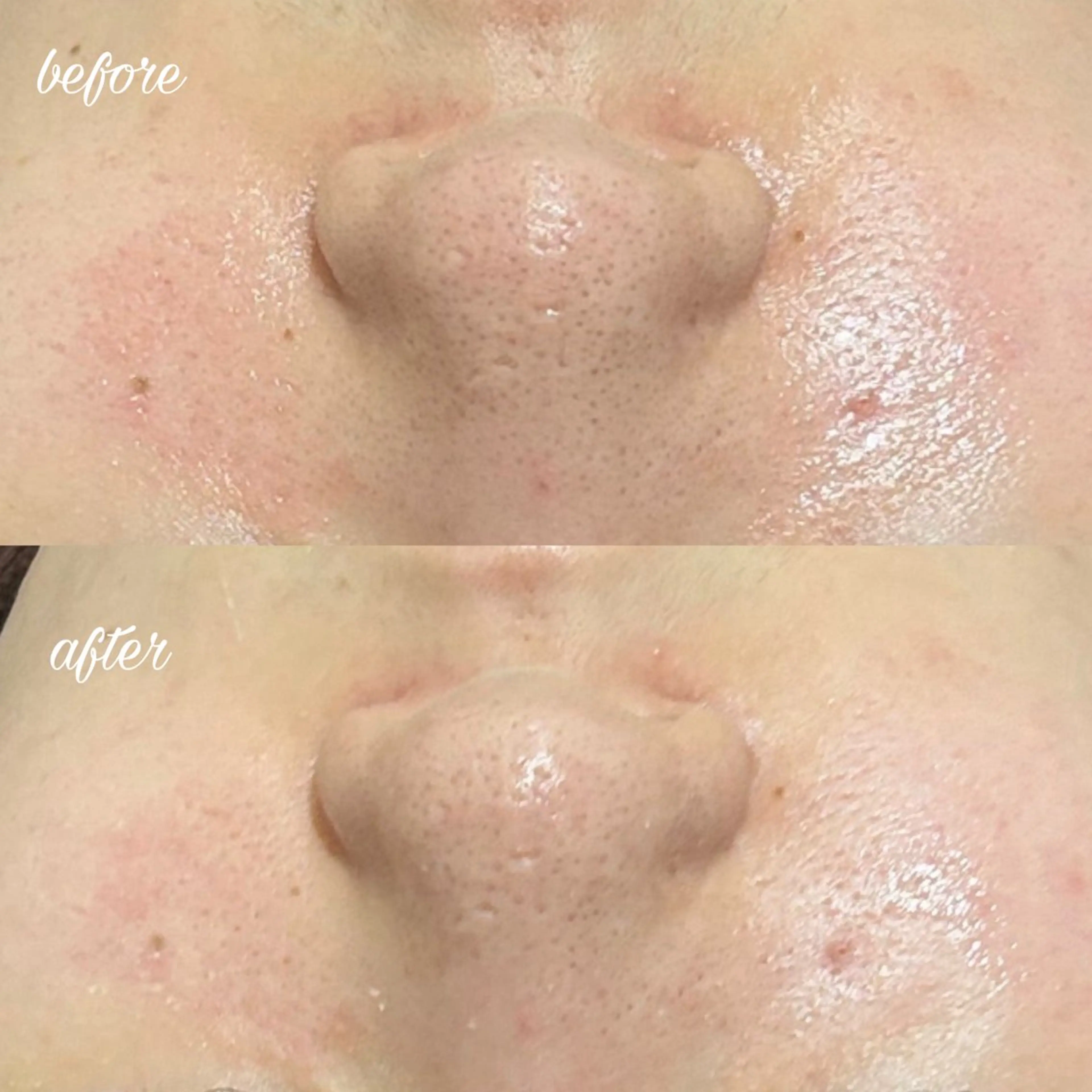 エステ merveilles所属・まつげ/整体/にきび ・アトピー専門サロンのマツエク・マツパデザイン