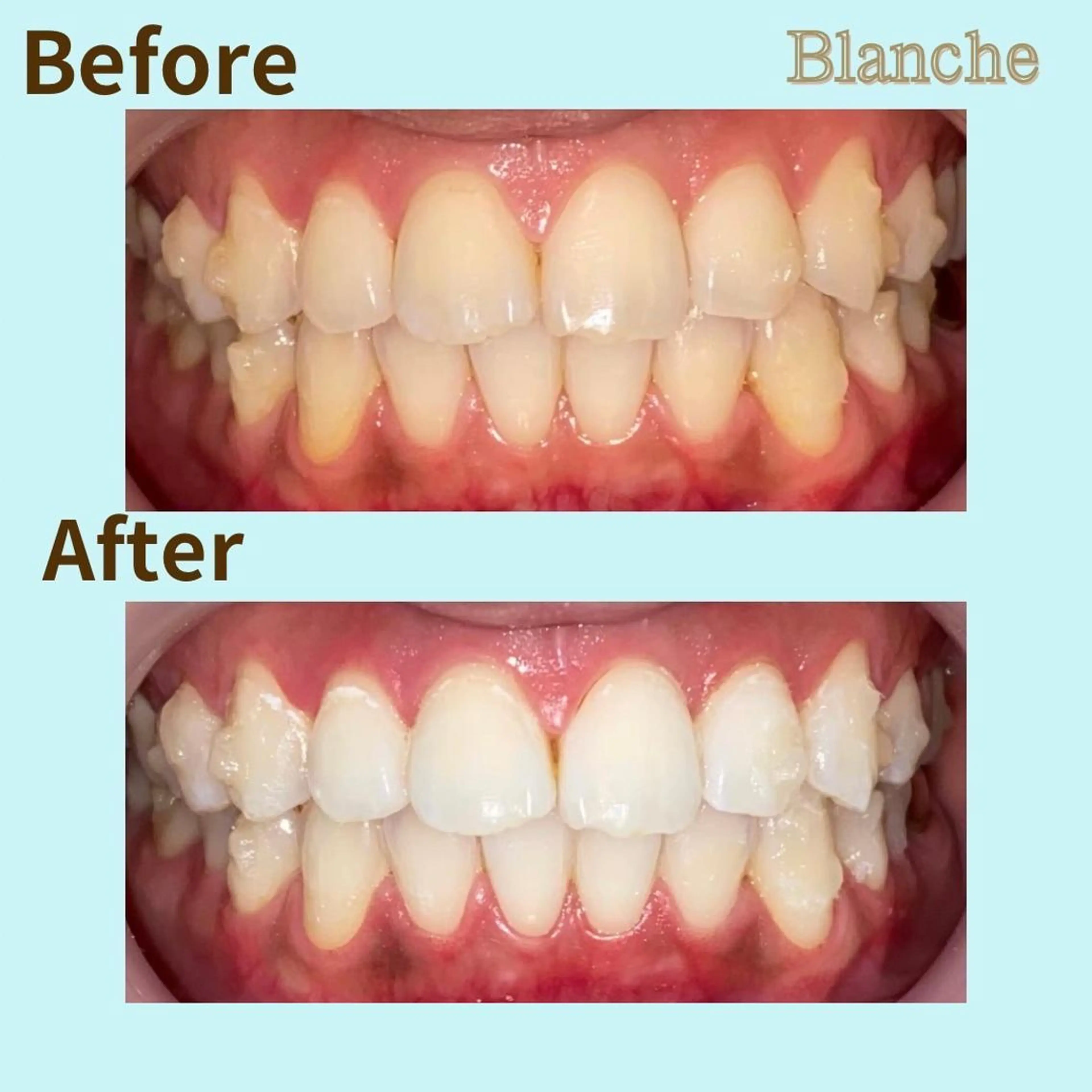 その他 Blanche 心斎橋のその他イメージ