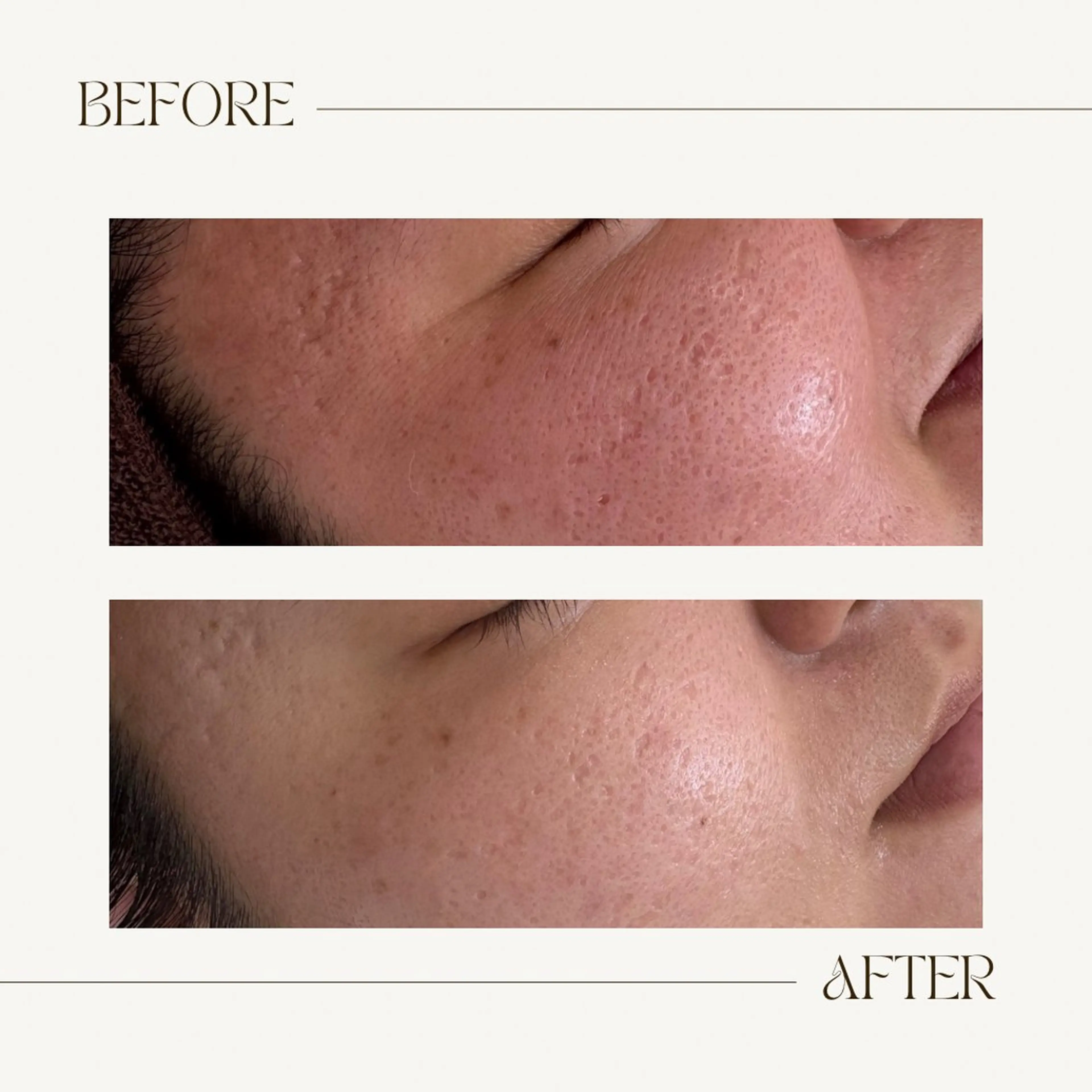 CEsalonEgg 齋藤のエステ・リラクイメージ