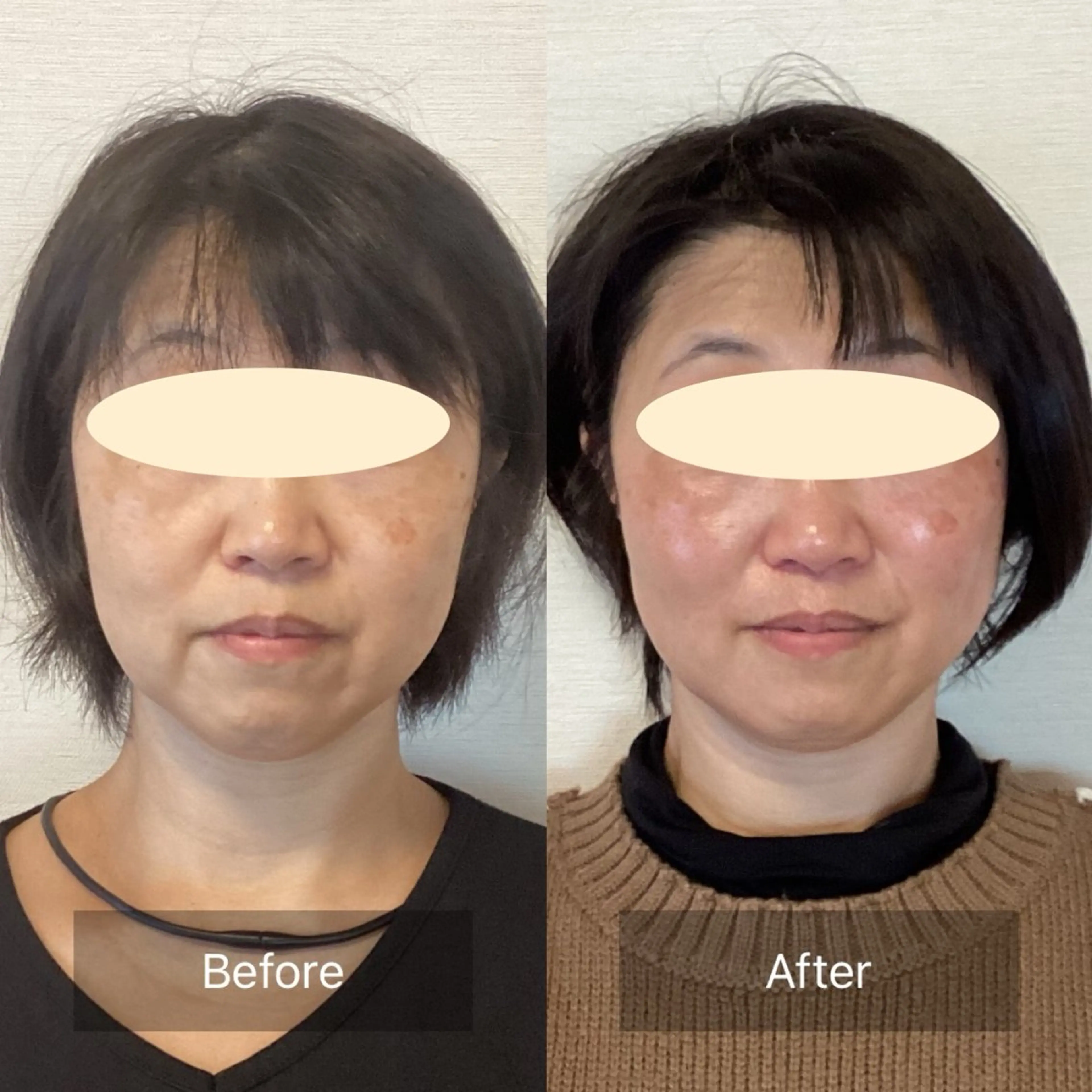 エステ リラク ルコナビューティ所属・小顔・歪み専門 井元 朋子のエステ・リラクイメージ