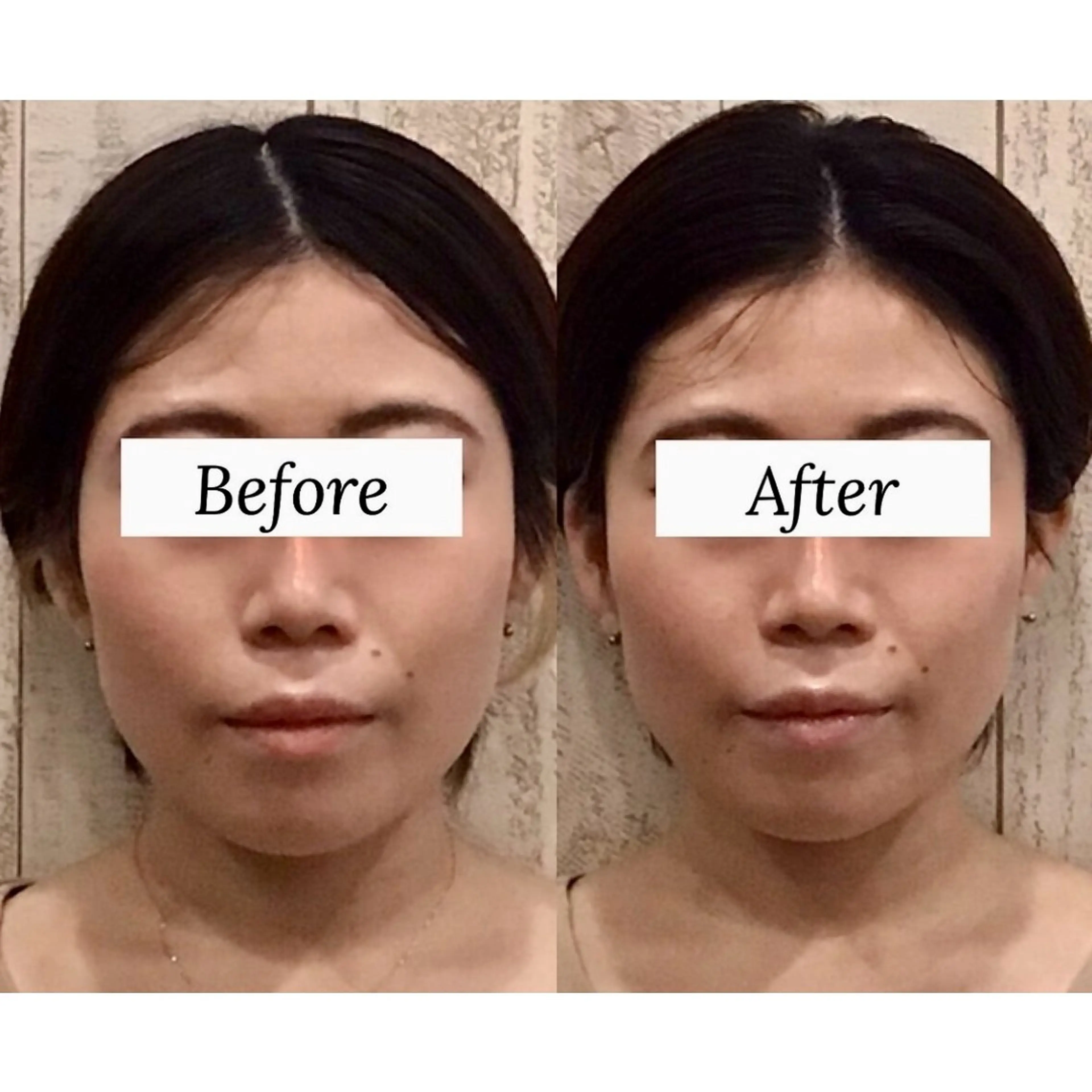 エステ リラク 小顔矯正Speed KOGAO渋谷本店のエステ・リラクイメージ