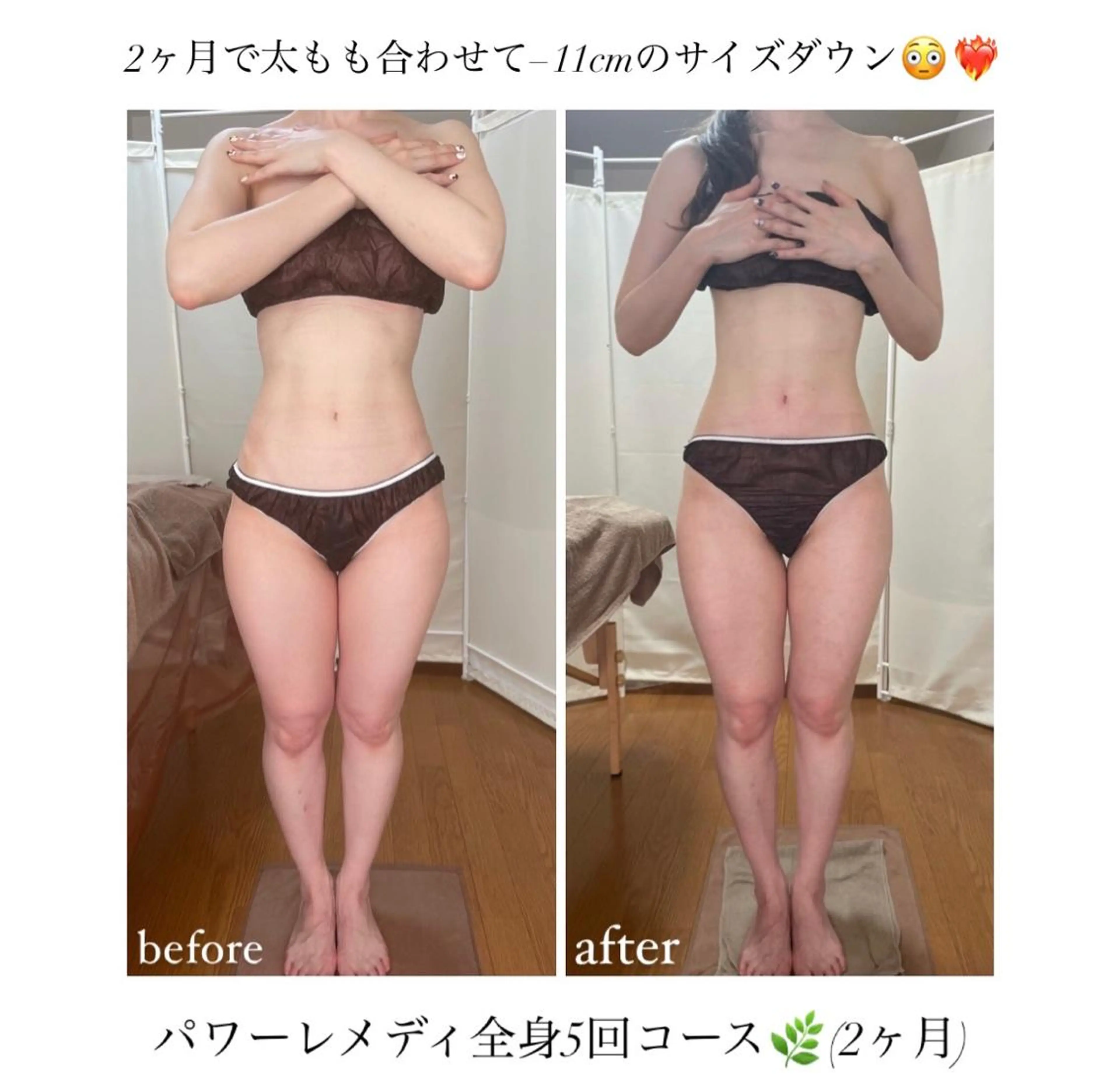 biloop所属・《本気痩せ×疲労改善 》  BILOOPのエステ・リラクイメージ