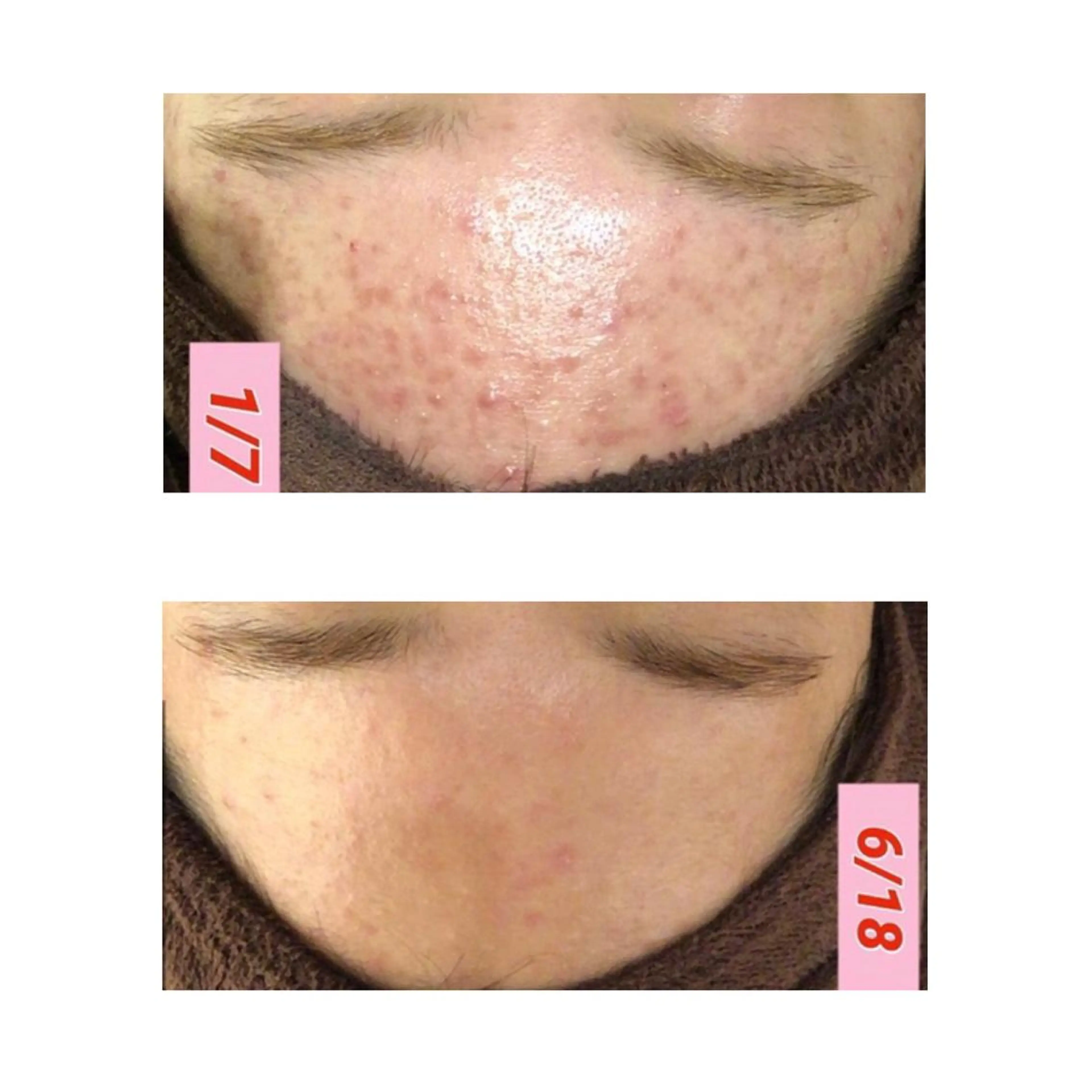 セミロング カラー パーマ ヘアアレンジ メンズ キッズ ネイル マツエク・マツパ 金の糸脱毛 産毛ケア専門のエステ・リラクイメージ