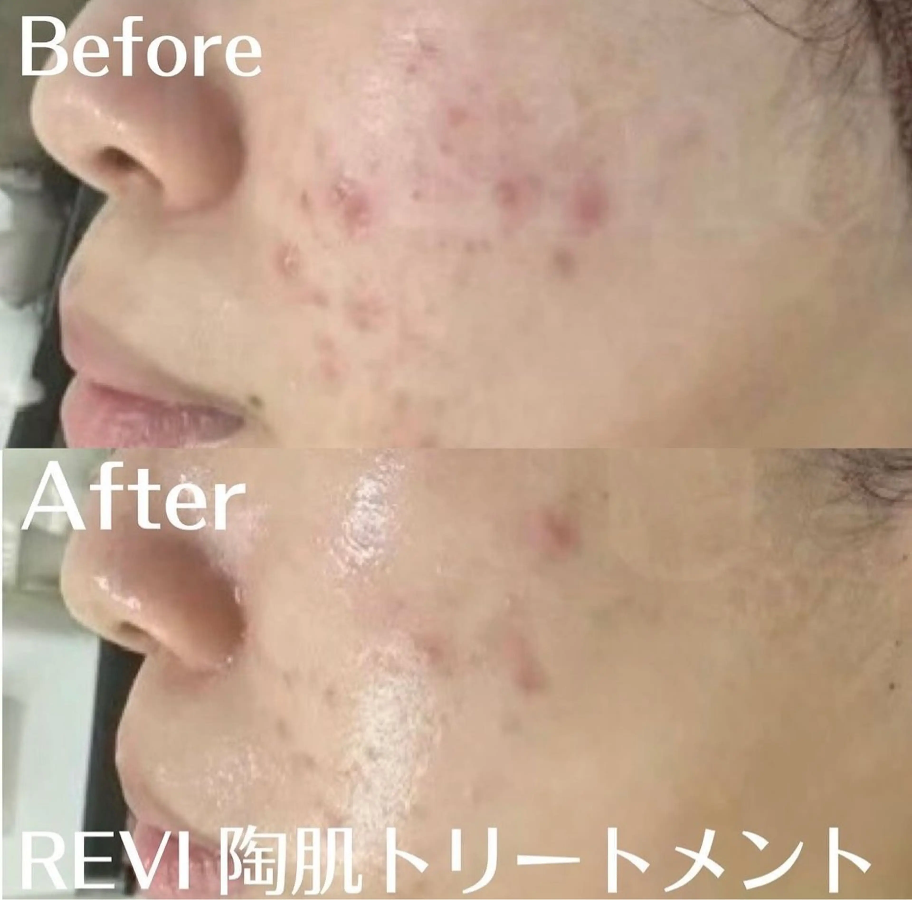 中目黒ハーブピーリン グ🌿ララピールのエステ・リラクイメージ