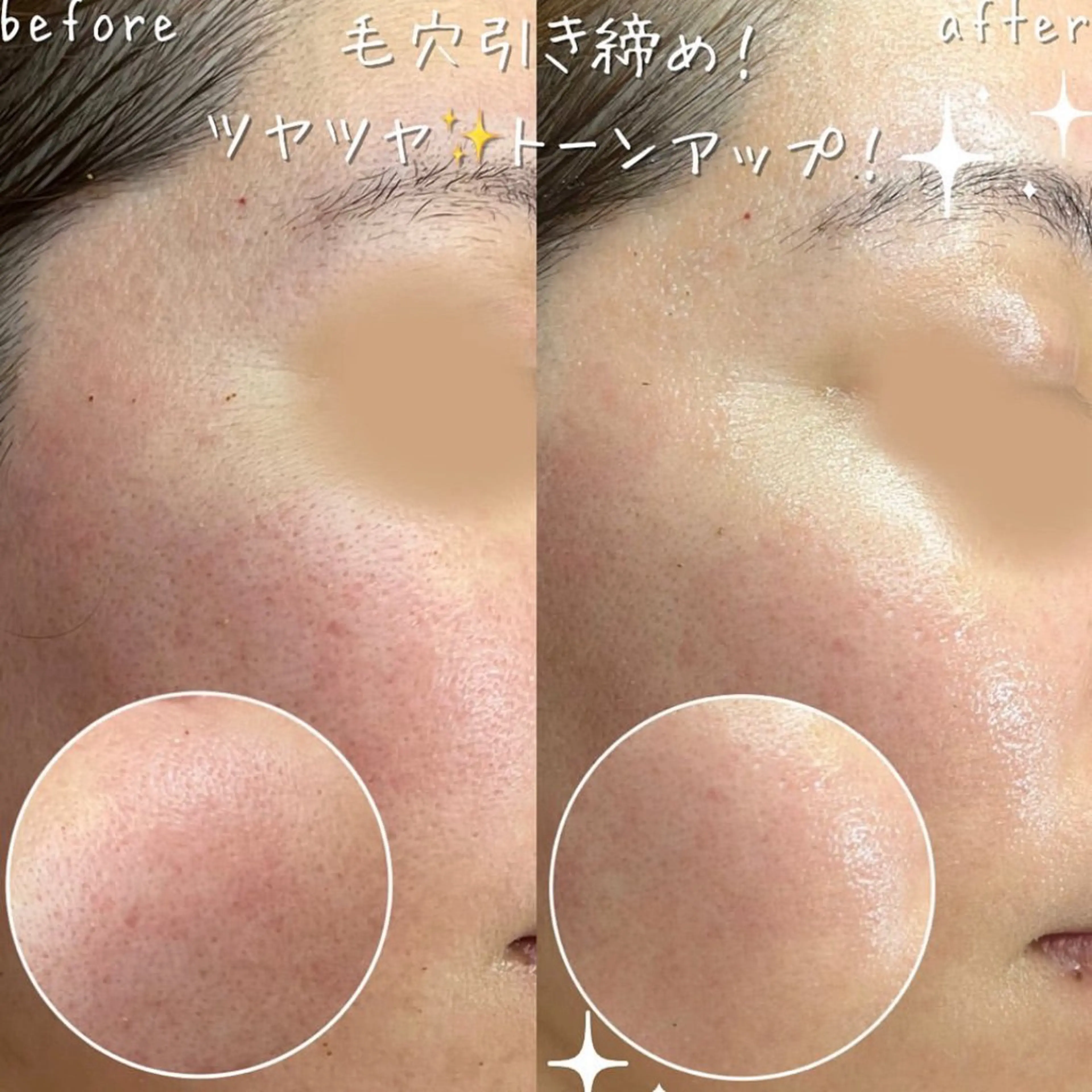 NA skin たまプラーザ　川島のエステ・リラクイメージ