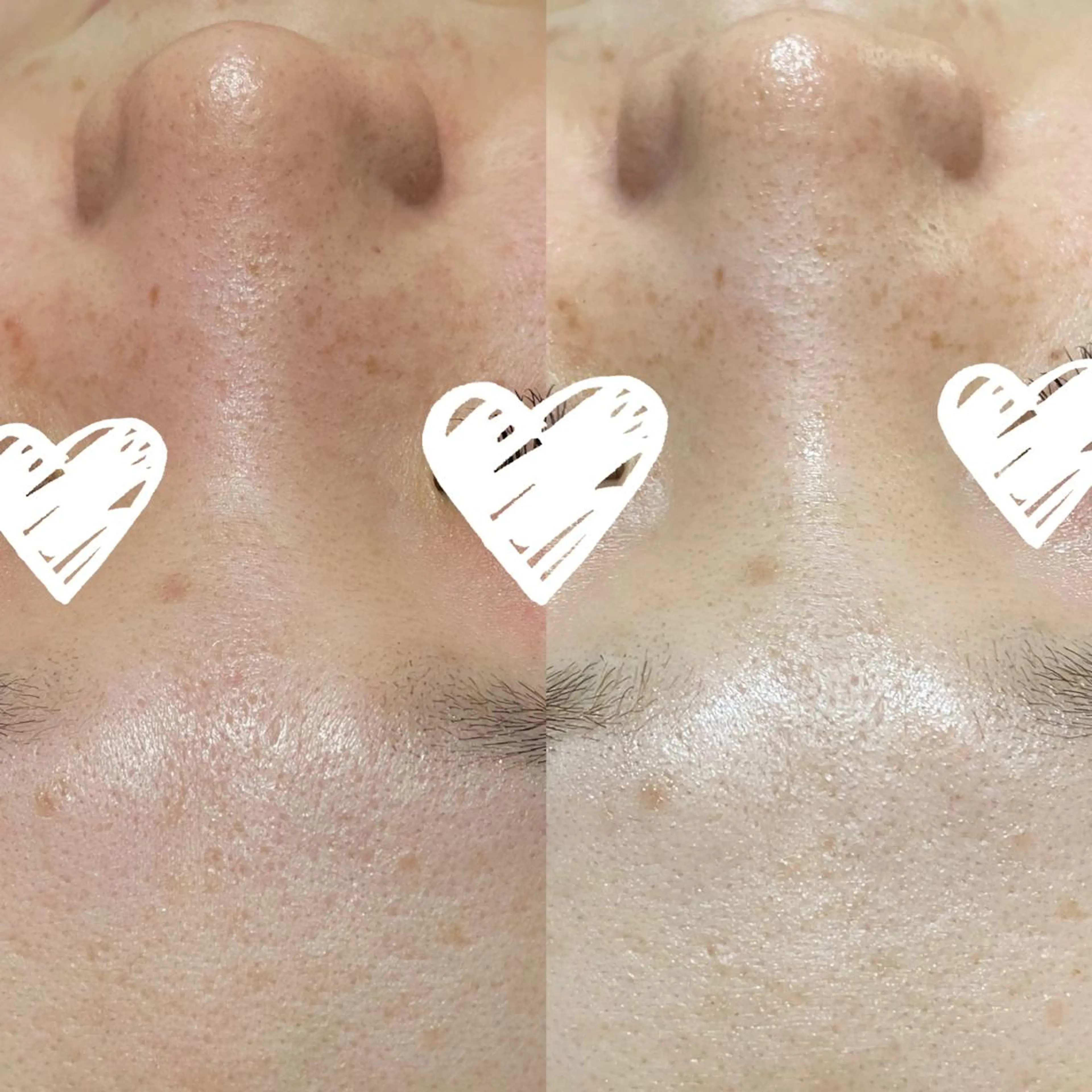 肌質体質改善サロン ミュリール 橋本店のエステ・リラクイメージ