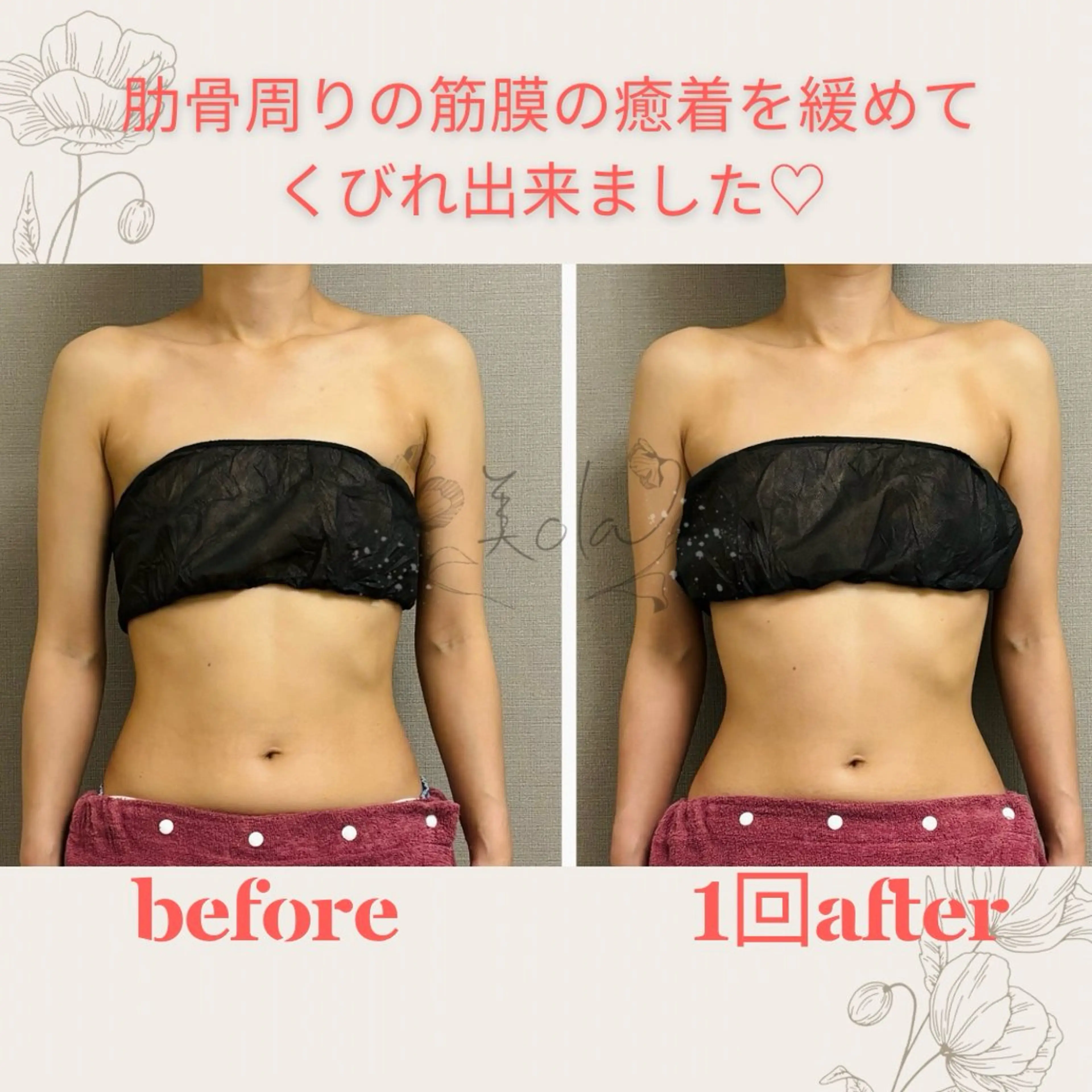 上半身集中の姿勢矯正✨見た目のシルエットも変わる✨お勧め筋膜リリース❣️疲れもスッキリ✨の写真