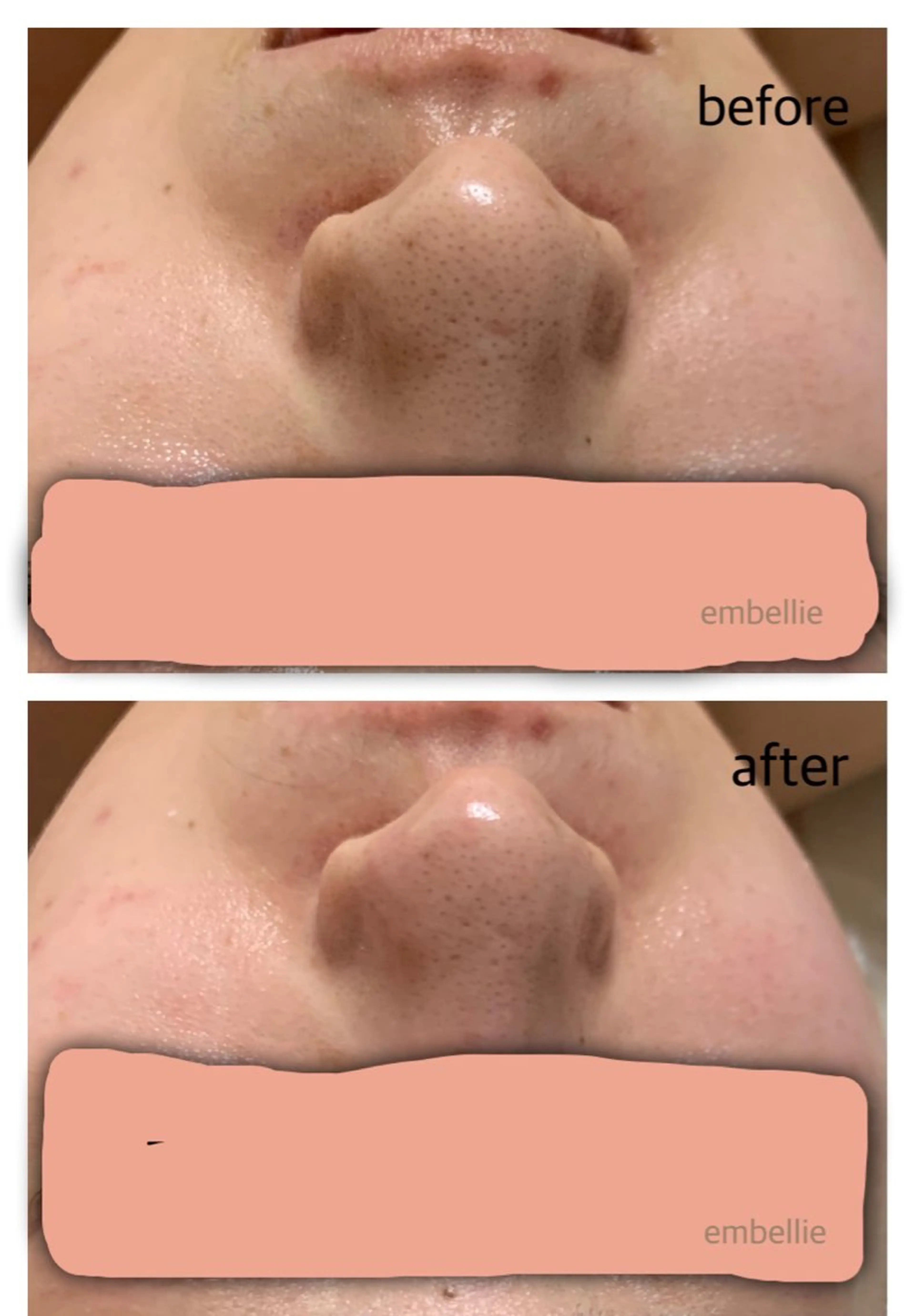 エステ miyasaka erikoのネイルデザイン