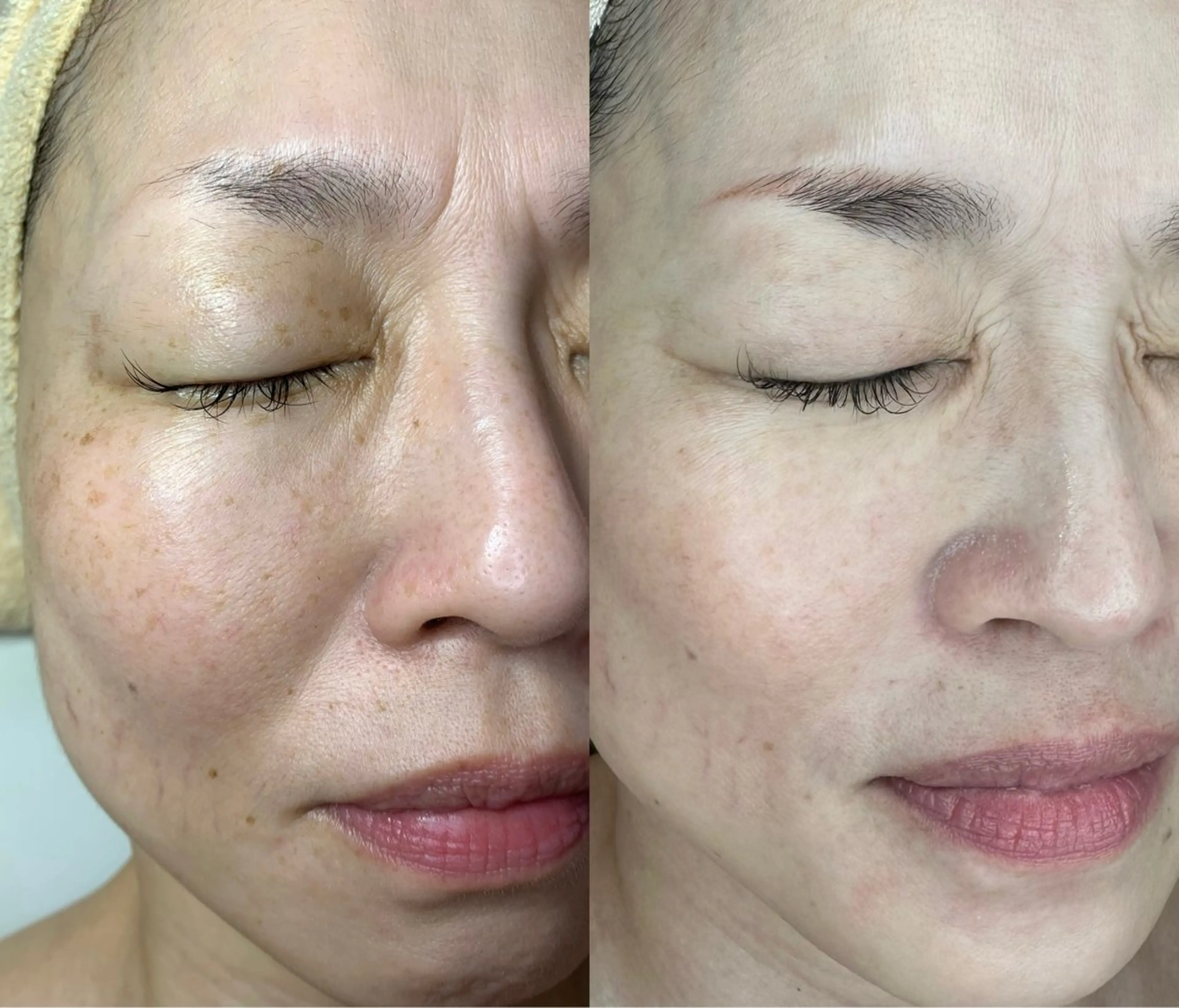 エステ シミケア専門サロン 10POINT.Kのエステ・リラクイメージ