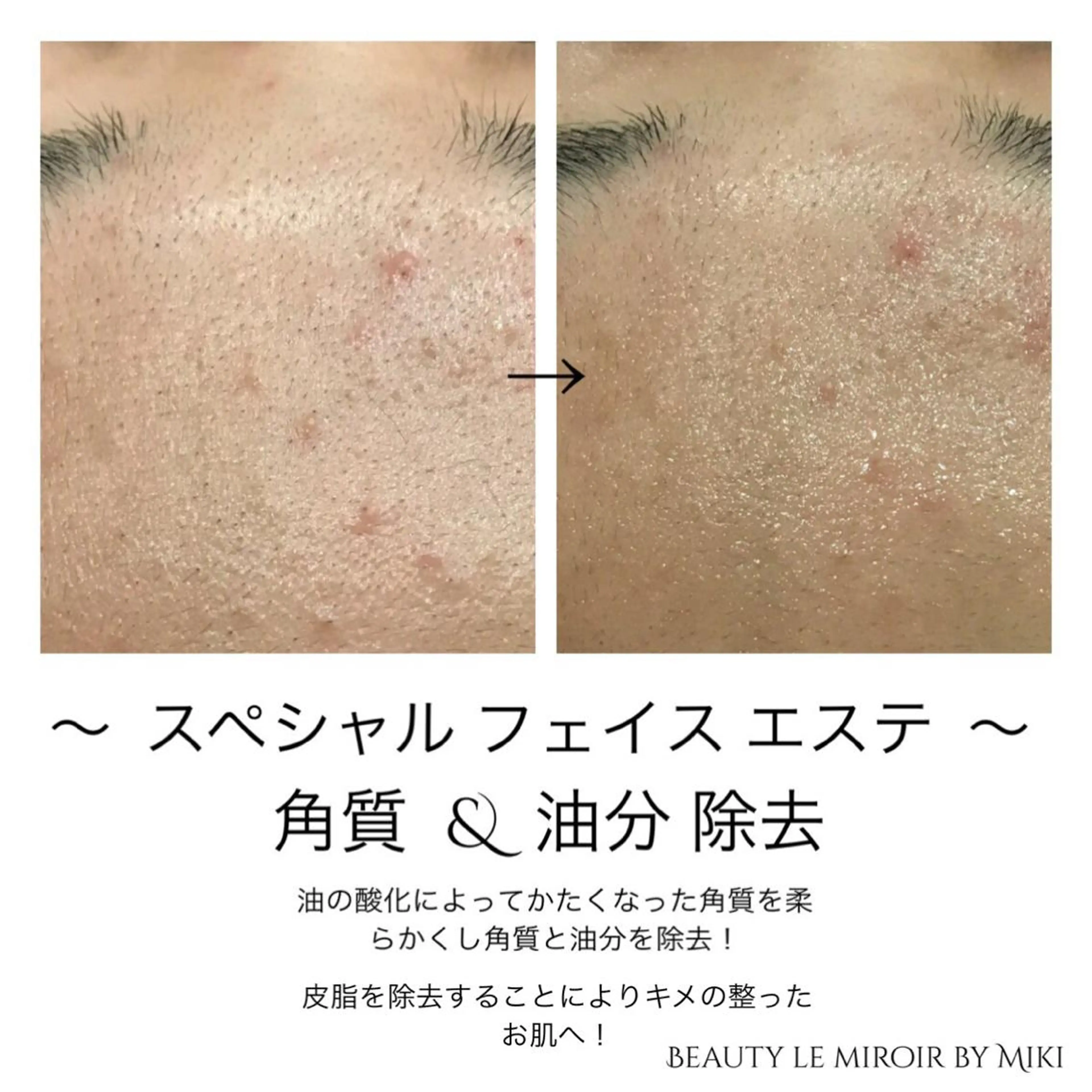 ビューティー ミロワールのエステ・リラクイメージ