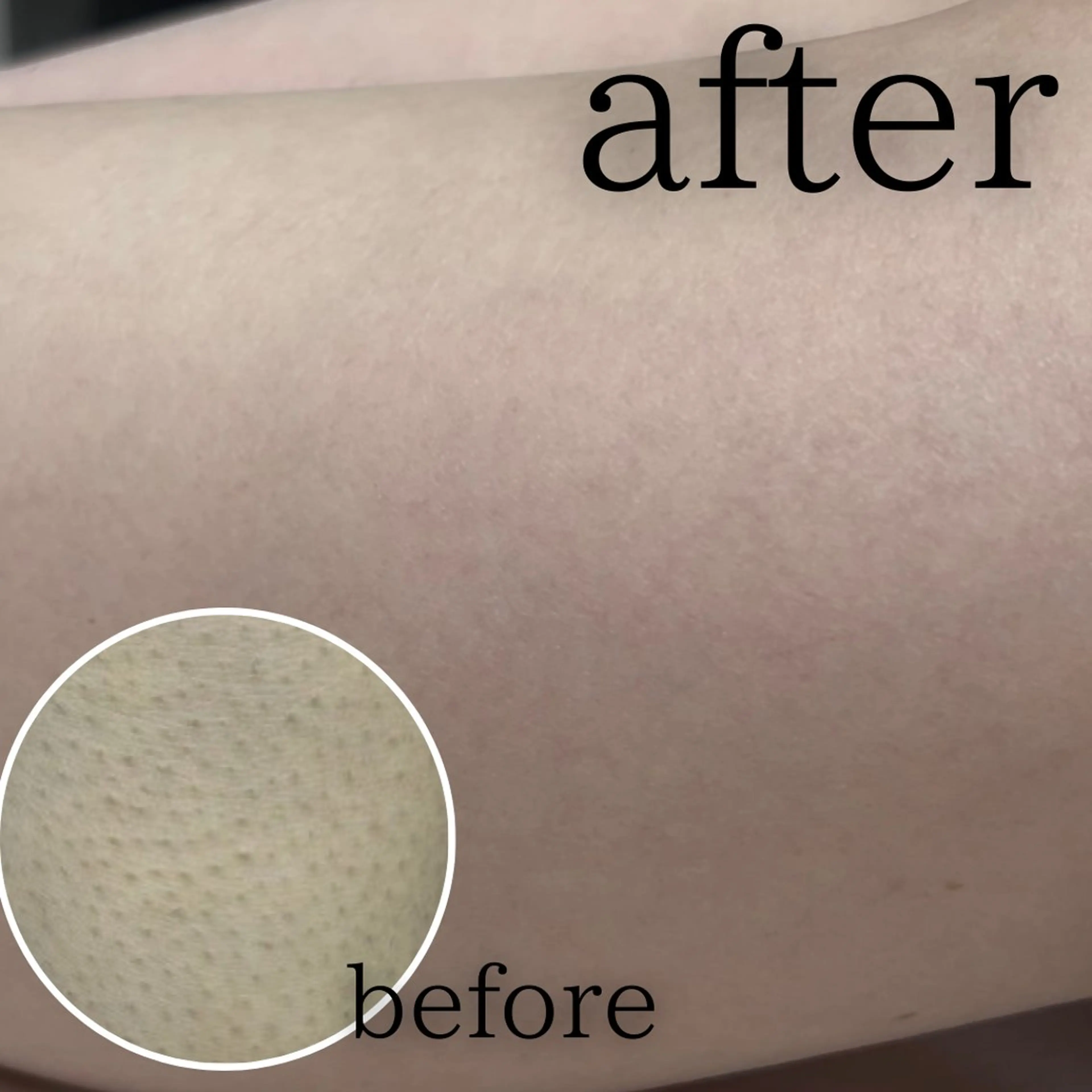 美肌脱毛&毛穴専門 Nico🐰ྀི♡のエステ・リラクイメージ