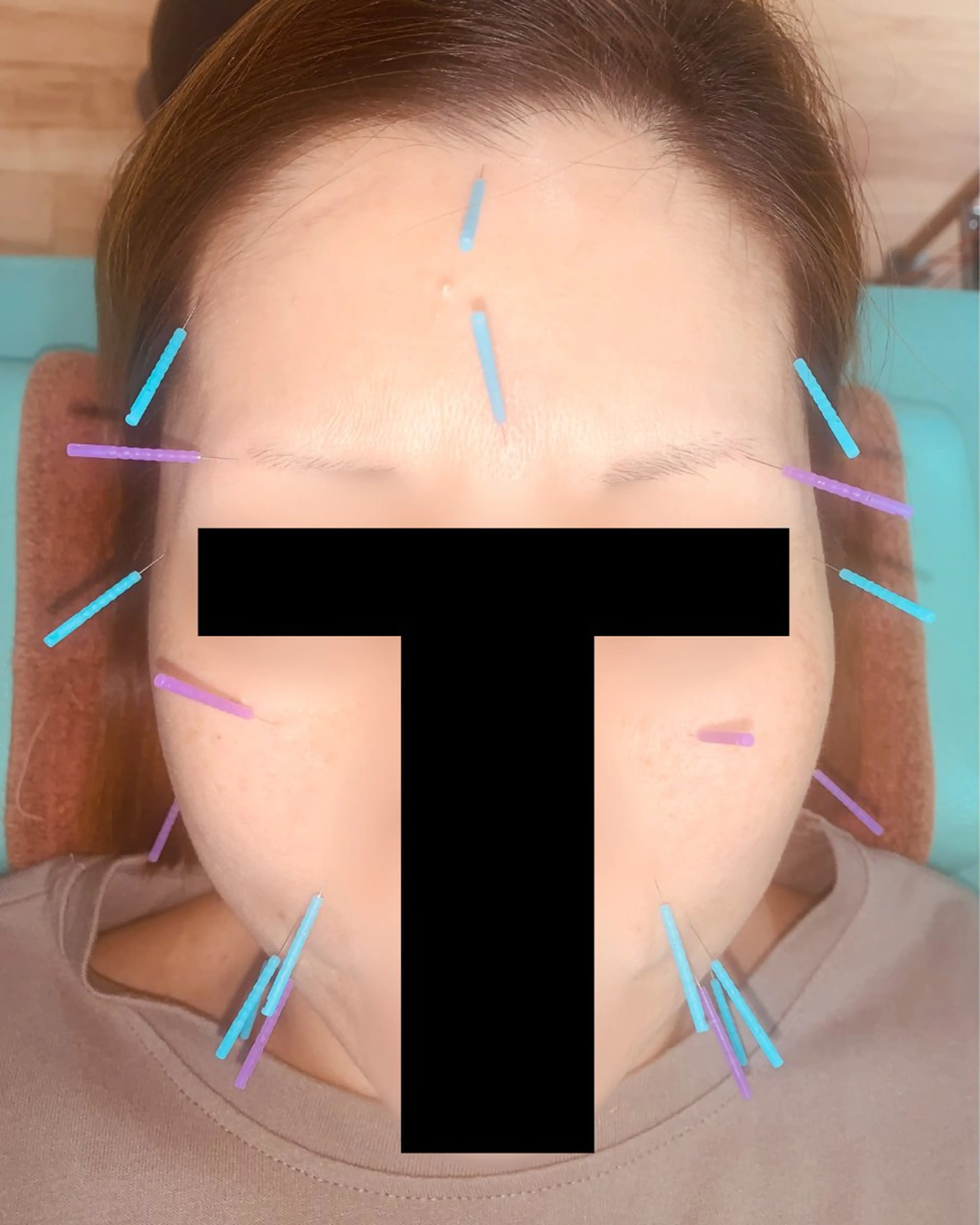 エステ リラク 河輪 鍼灸接骨院のエステ・リラクイメージ