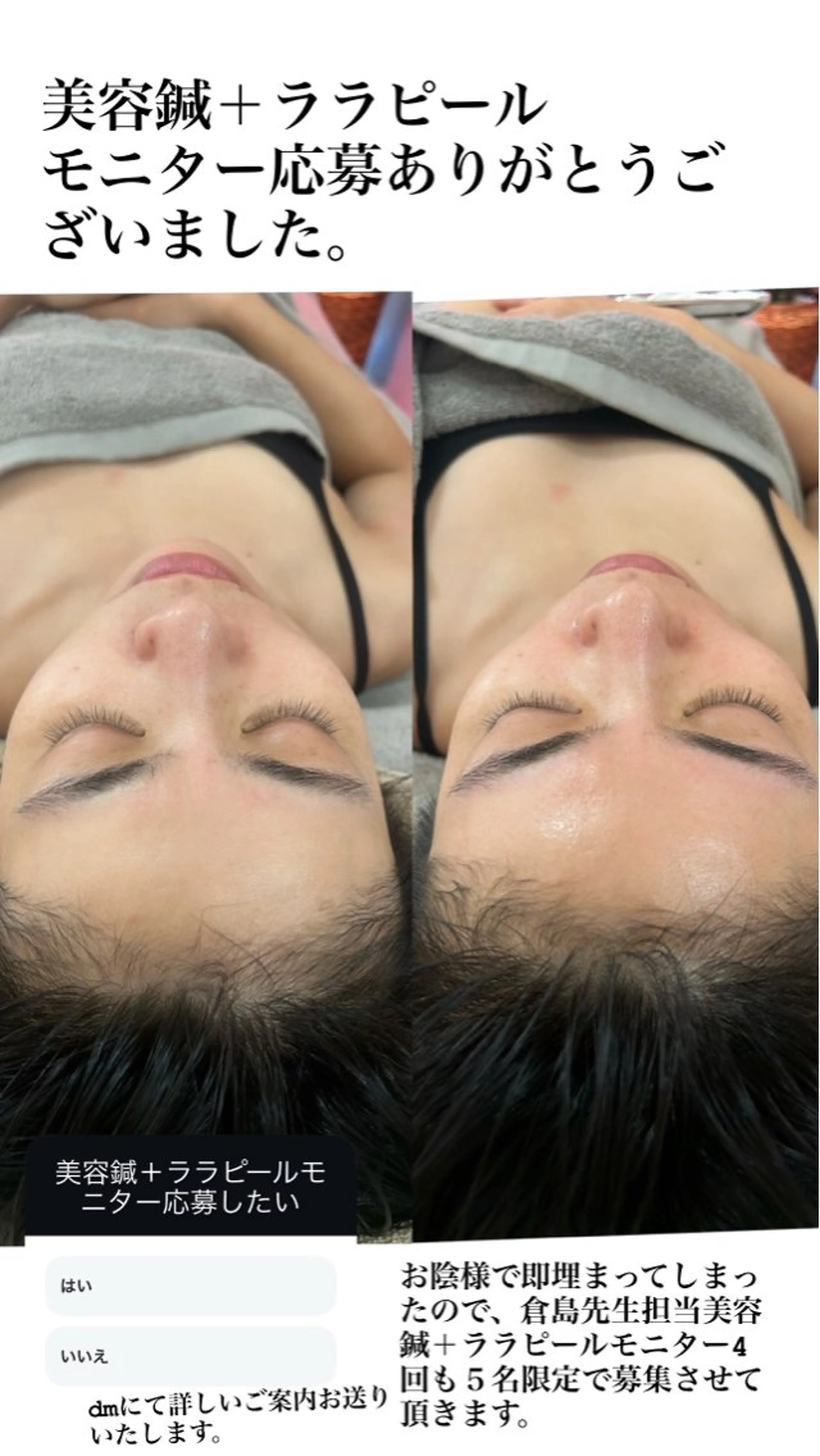 エステ リラク 美容鍼灸サロン mahoroba院長のエステ・リラクイメージ