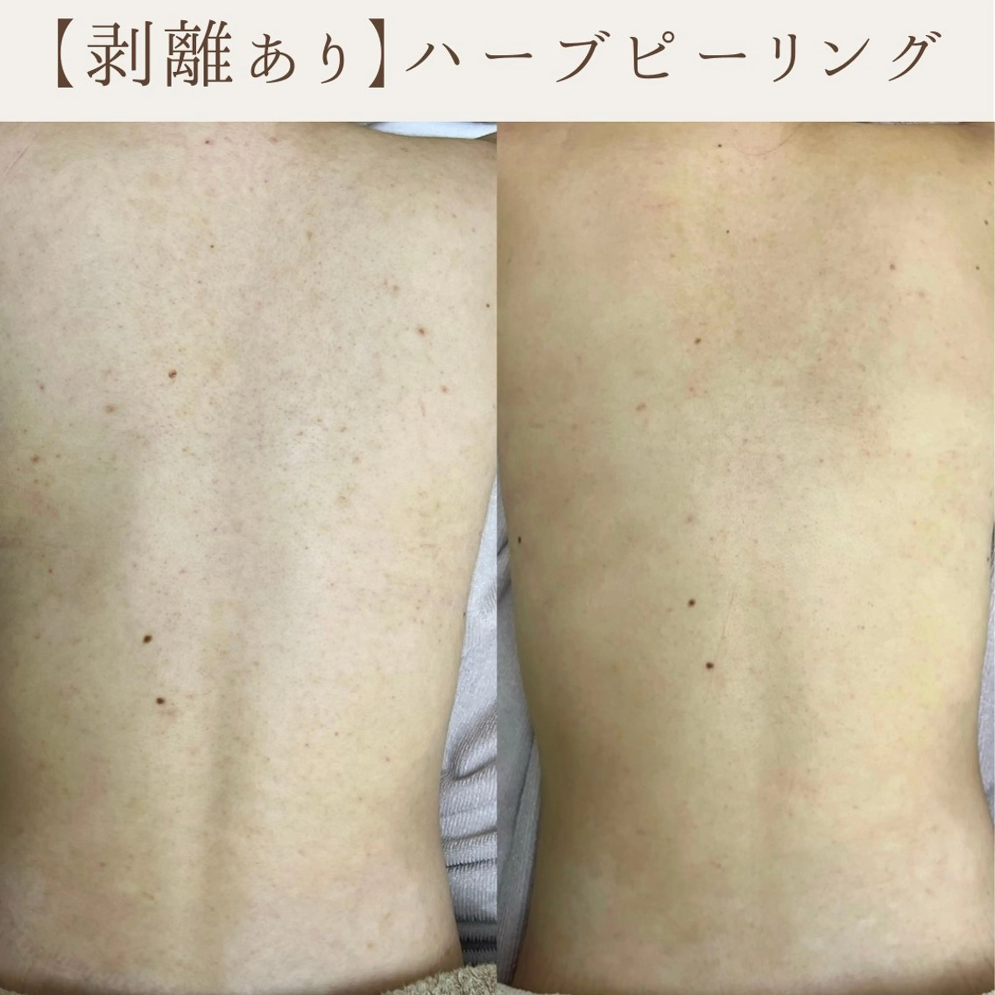 肌質改善サロン renew/ｳｴｷのエステ・リラクイメージ