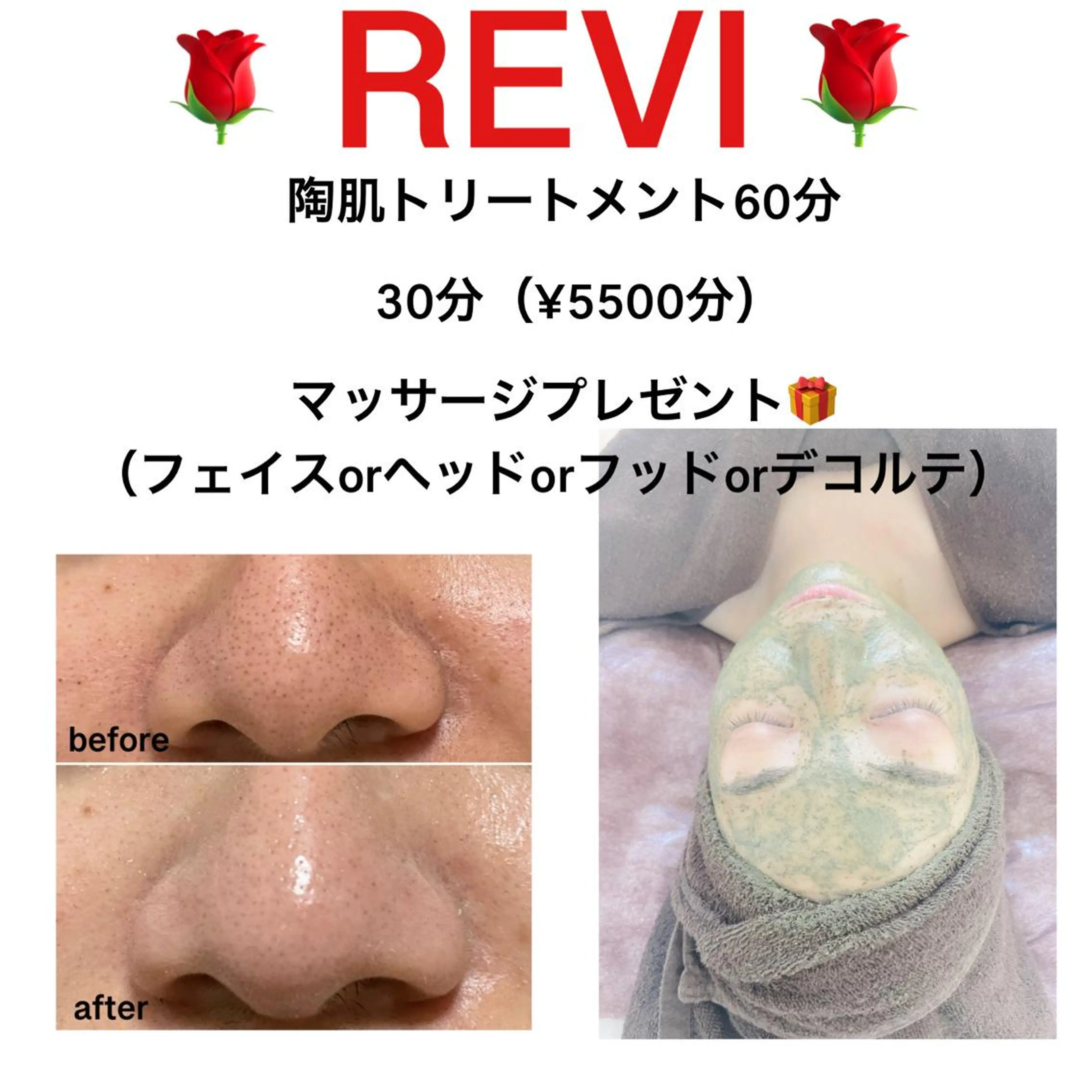 🍁ご新規様限定🍁陶肌トリートメント＋フェイシャルマッサージ30分🎁小顔、リフトアップ、むくみ、たるみ、ほうれい線の写真