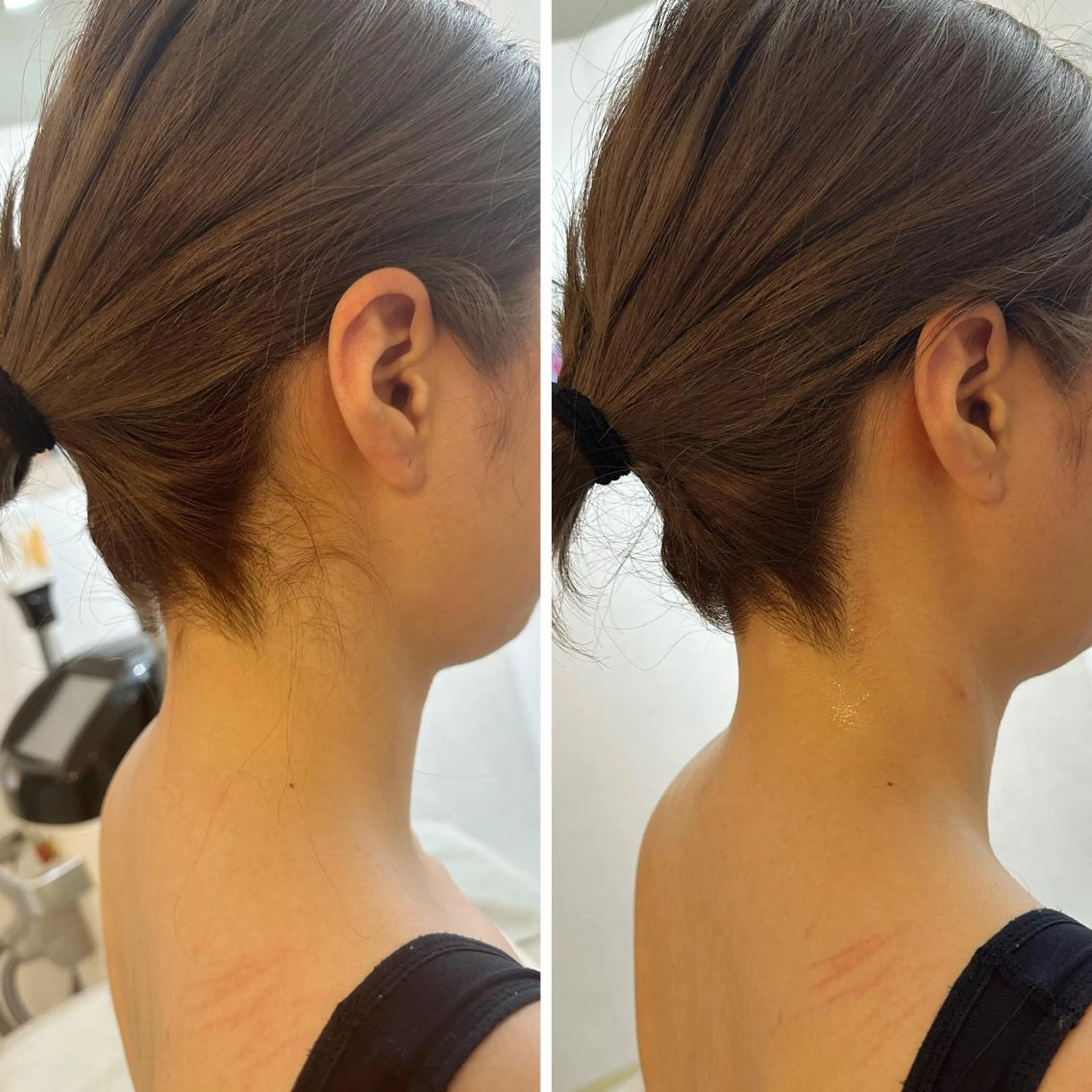 うなじ脱毛/美肌脱毛 LABELのエステ・リラクイメージ