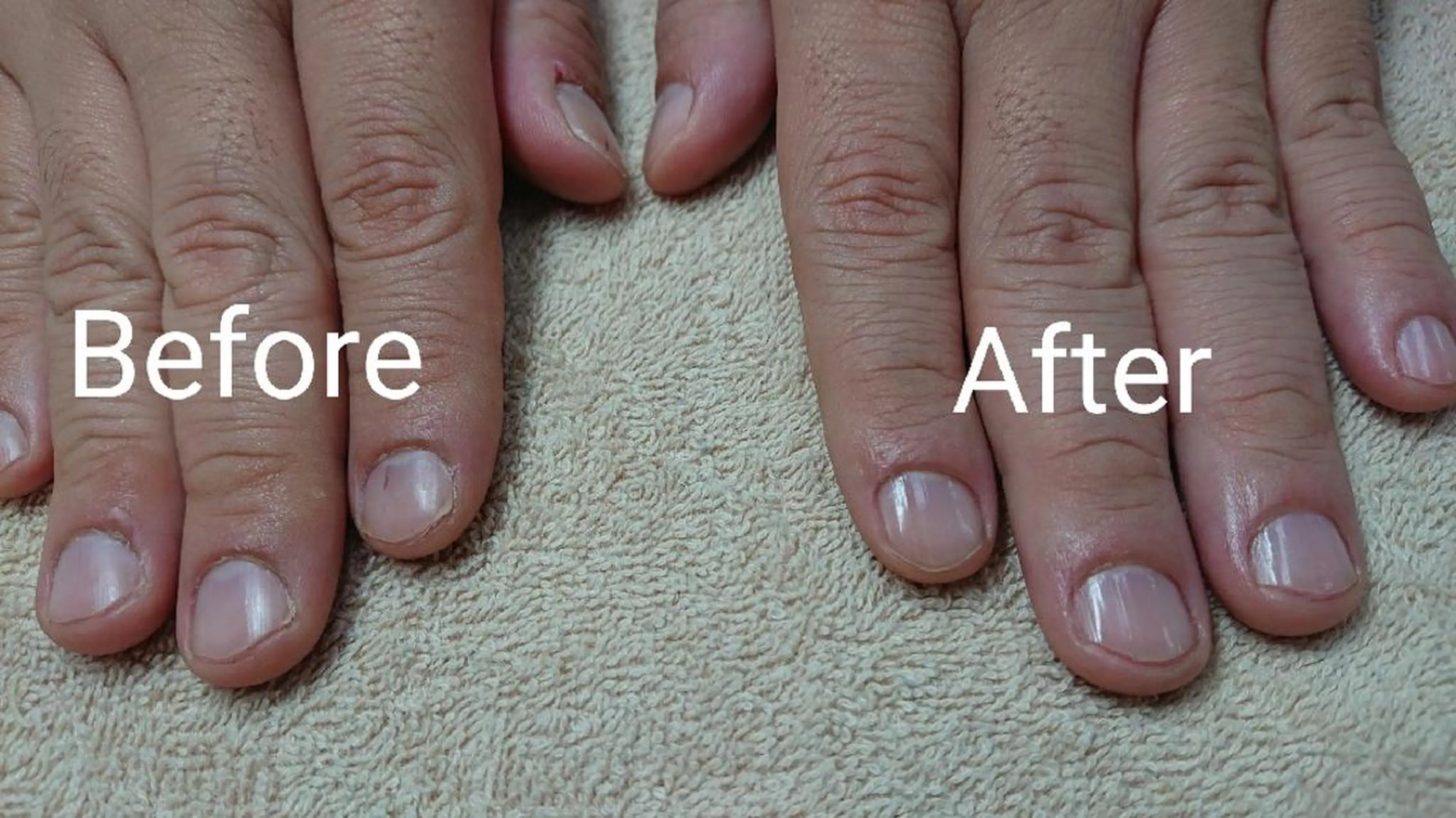 【メンズにも人気】ハンドケアコースの写真