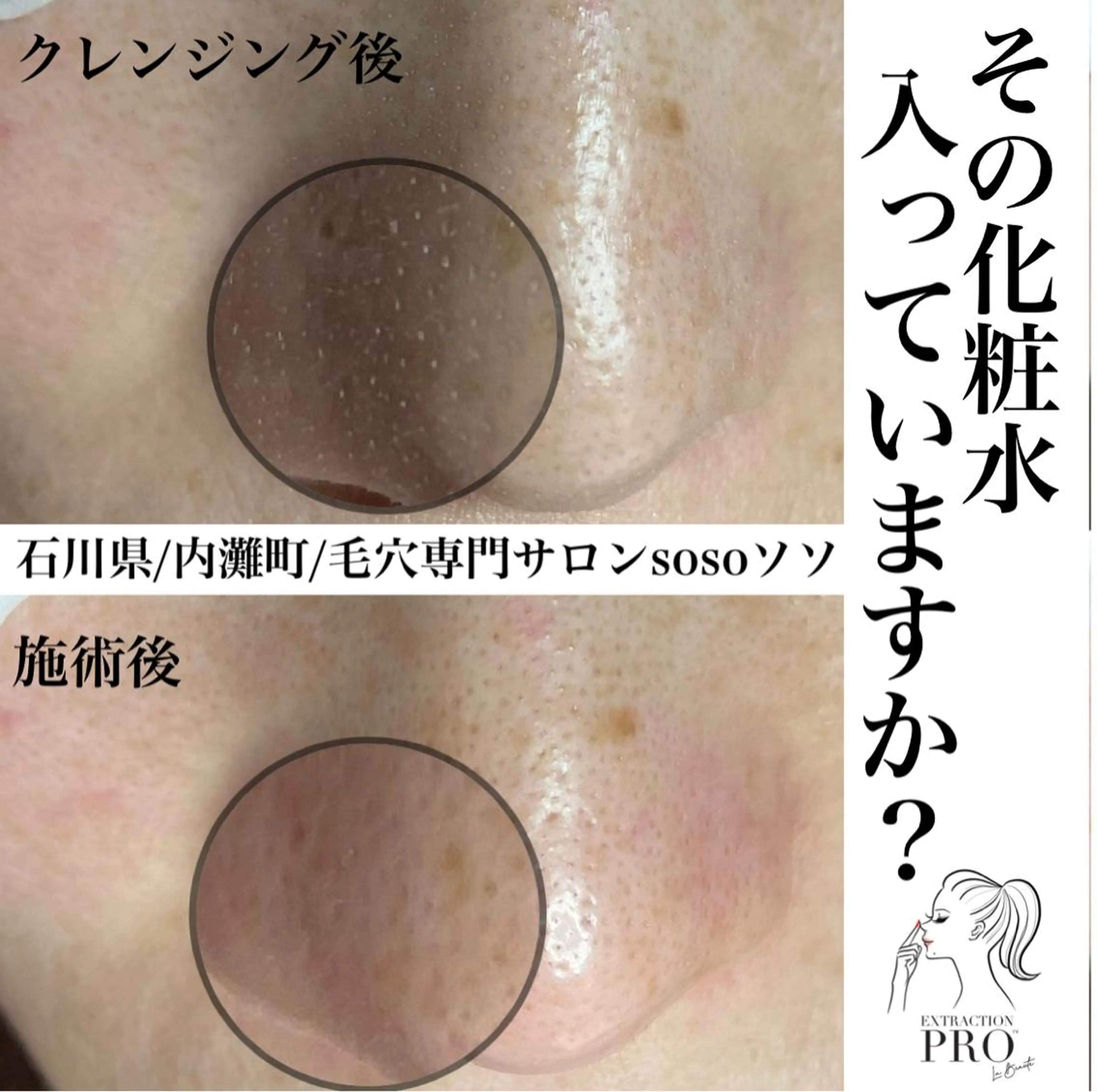 salon soso(ソソ)のエステ・リラクイメージ