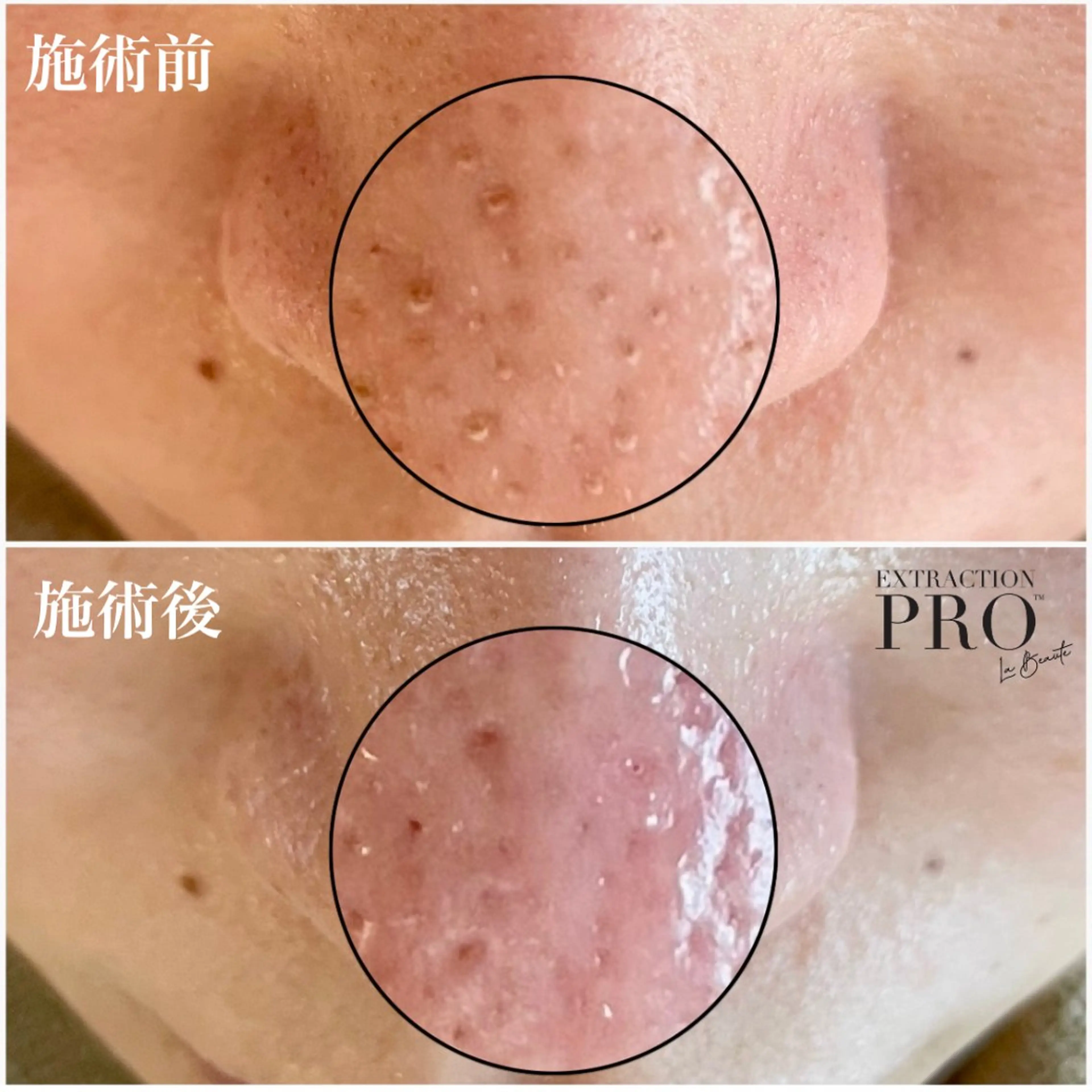 毛穴専門店アイミュー mamiのエステ・リラクイメージ