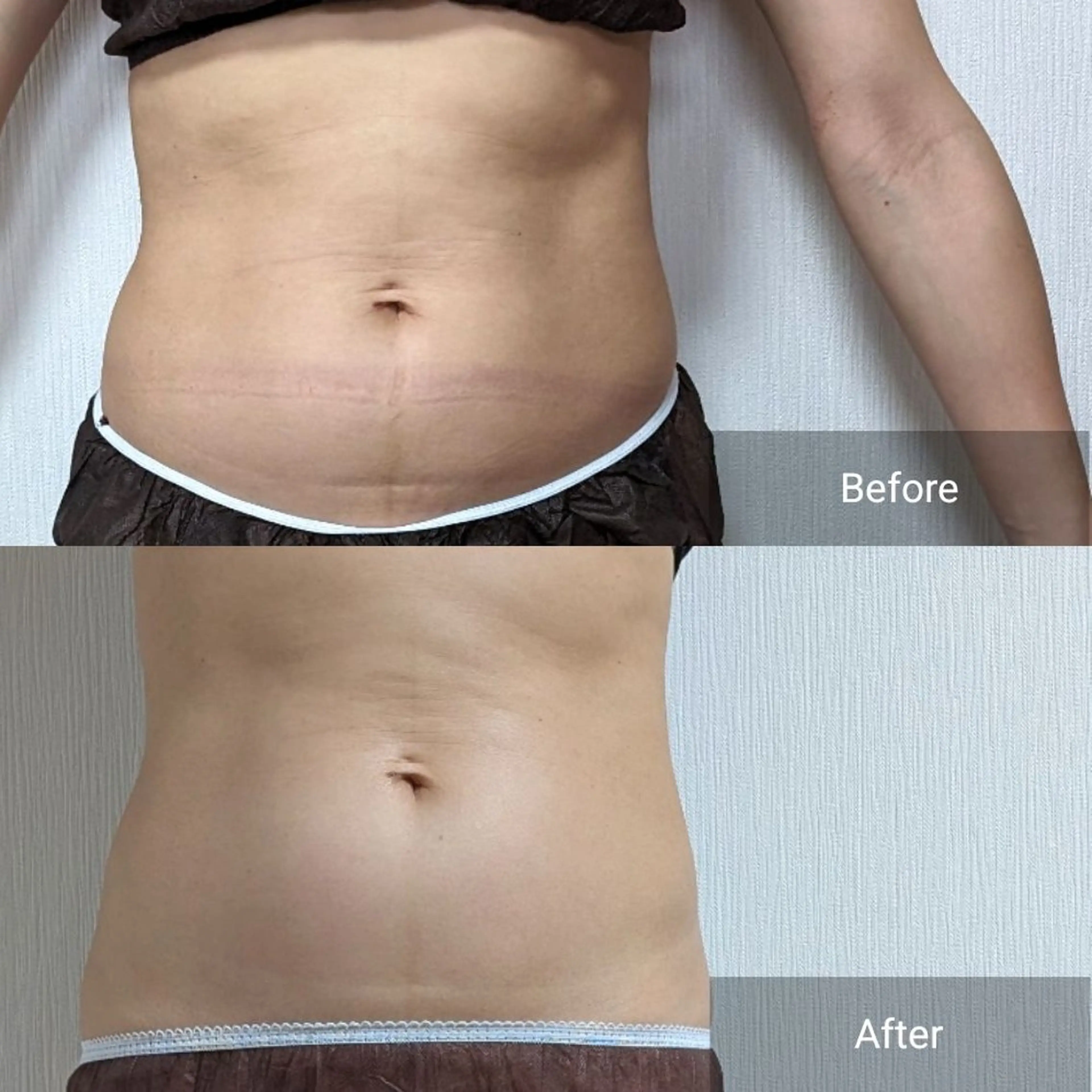 エステ nail RiRi アトレナチュラのエステ・リラクイメージ