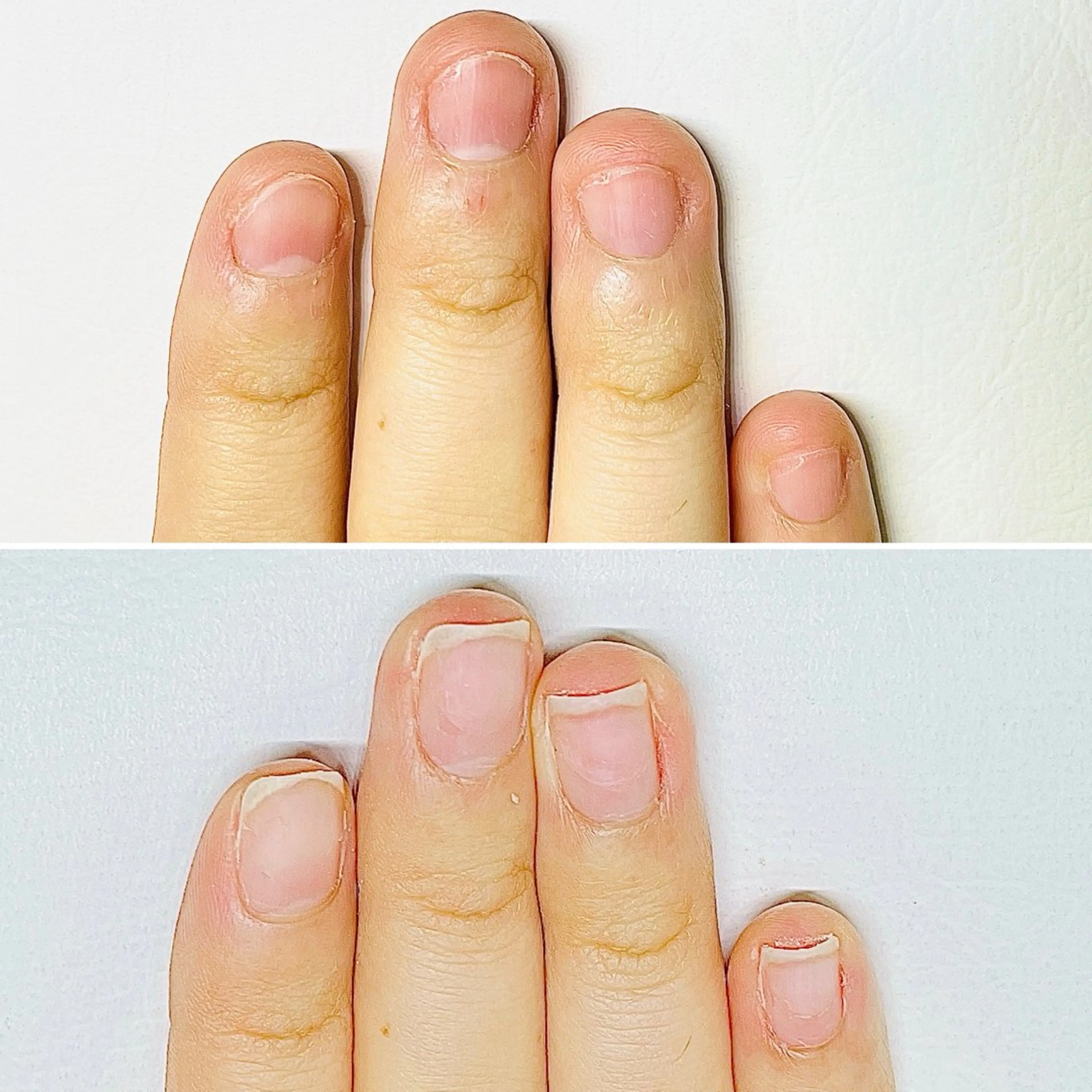 ネイル 深爪・巻き爪 専門サンセリテのネイルデザイン