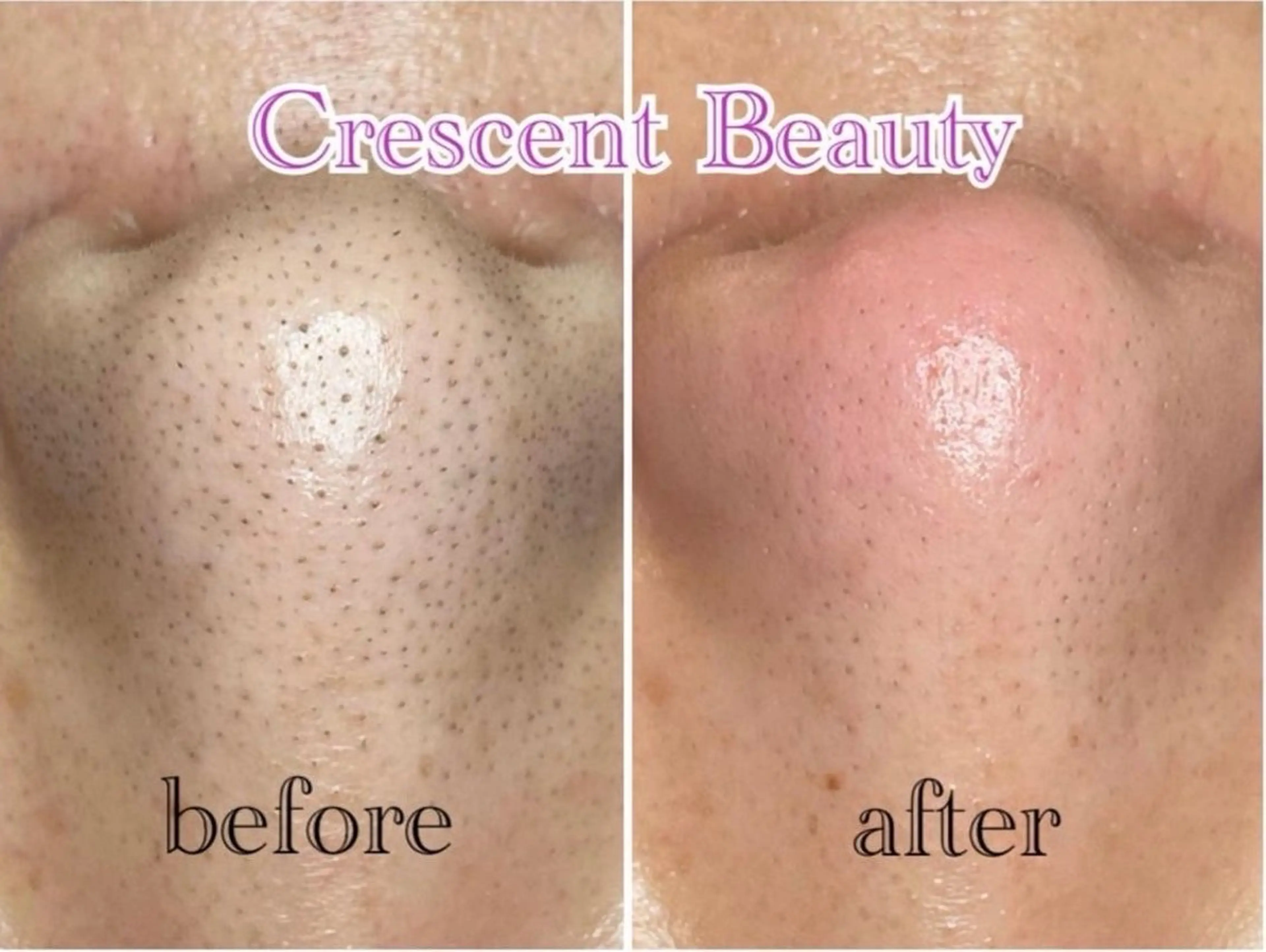 crescent 福寿のマツエク・マツパデザイン