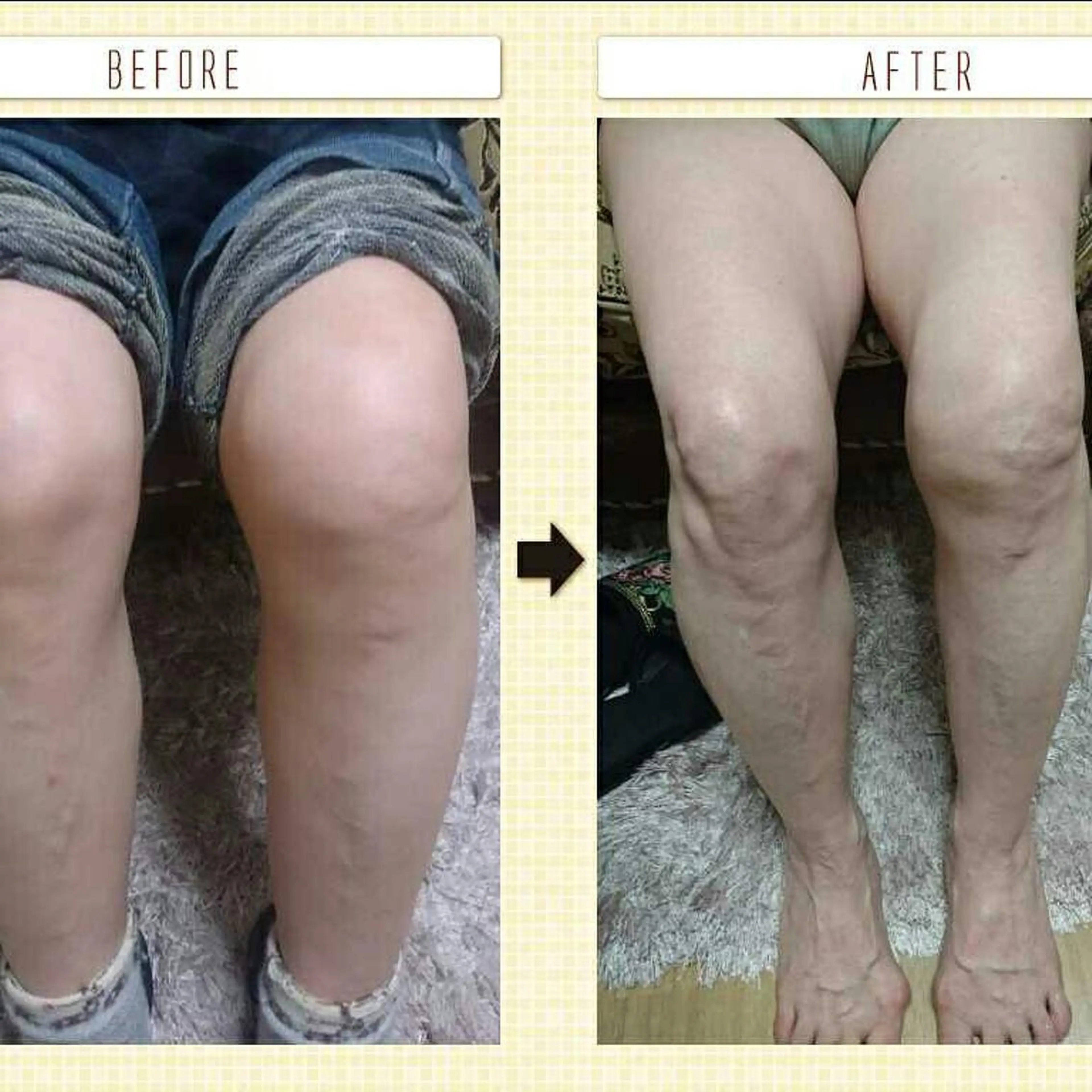 Arebeau 健康的にダイエットのエステ・リラクイメージ