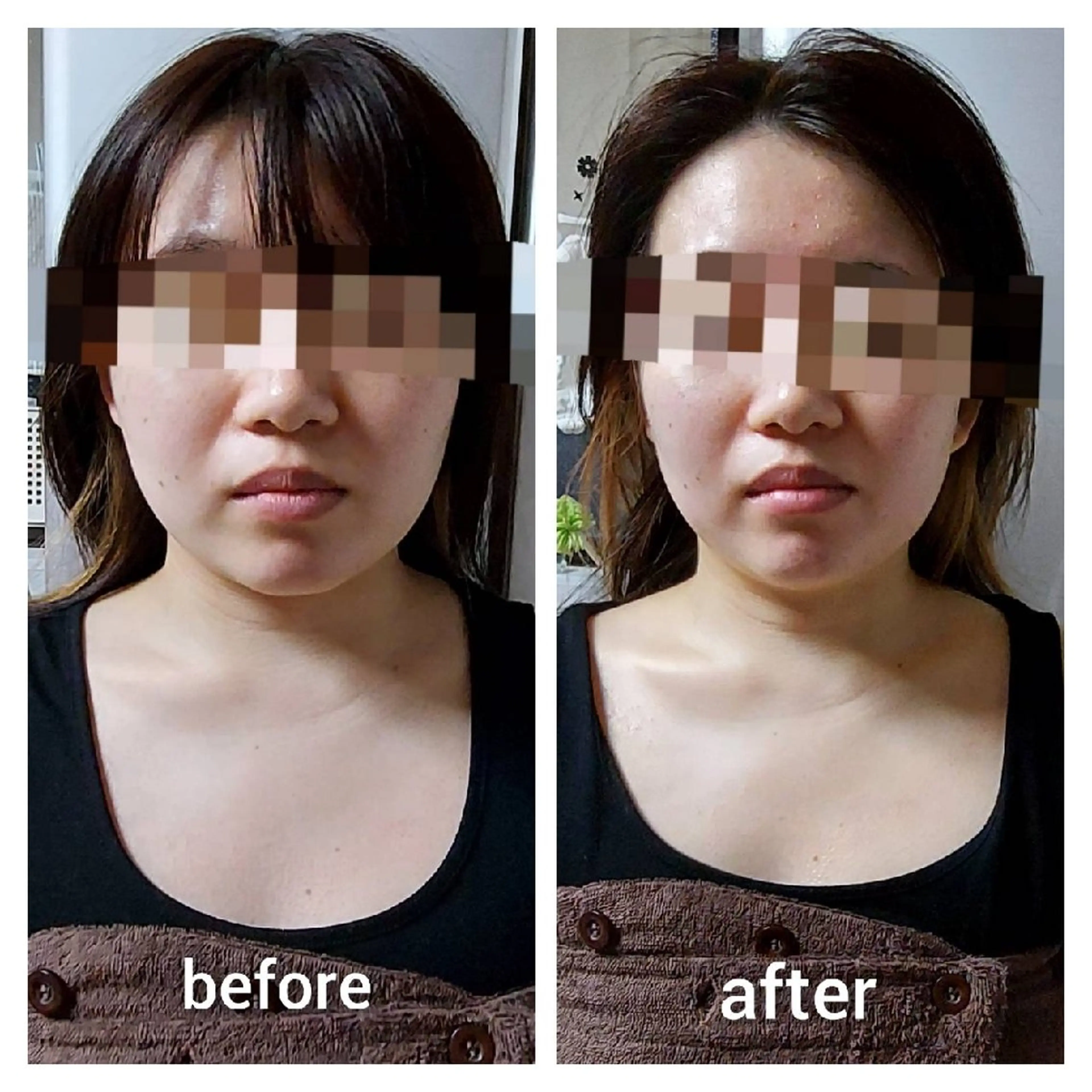 🌿ハーブピーリング TO BE HERBのエステ・リラクイメージ