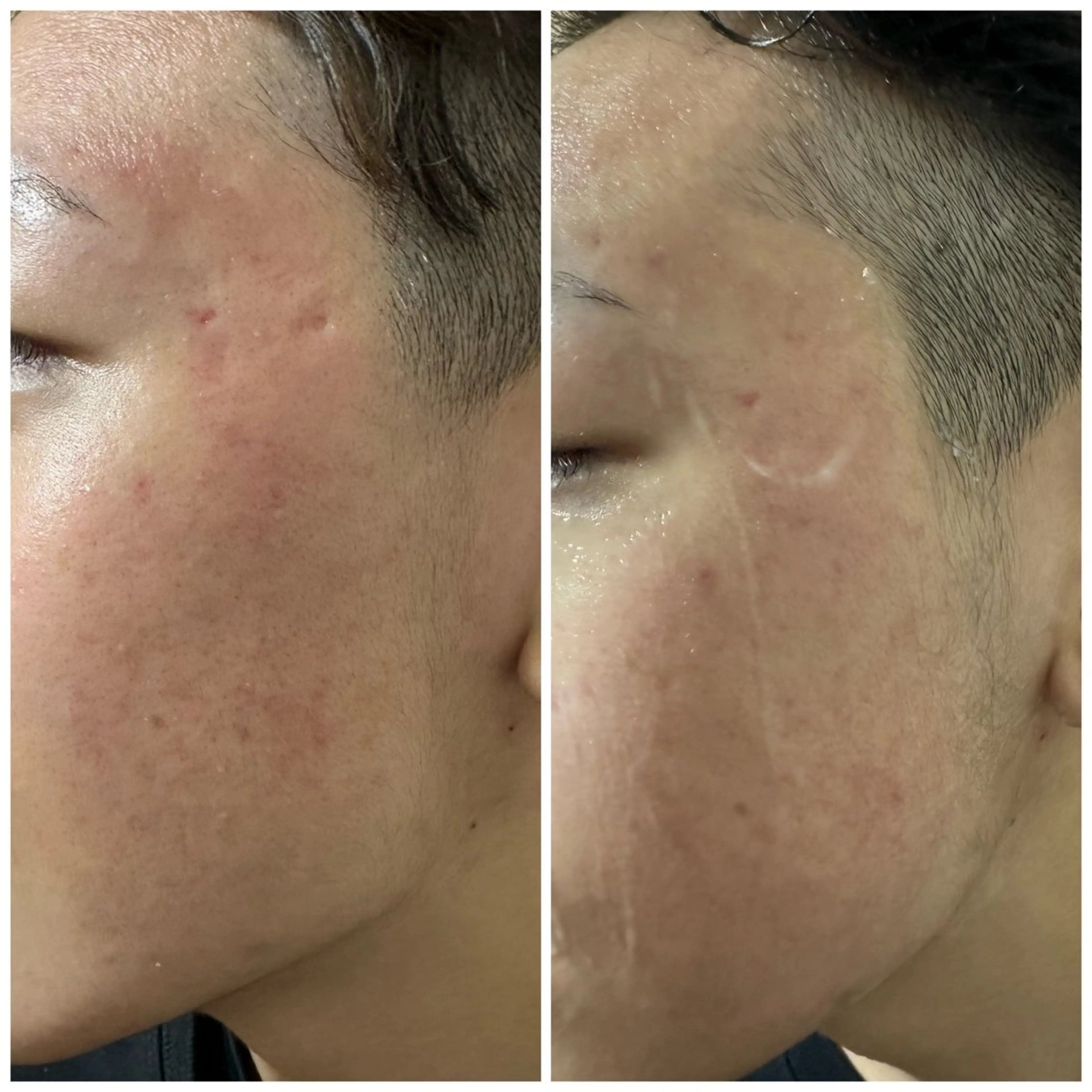 ⚠️ご予約殺到の為、１ヶ月5名で締切⚠️満足のお声多数✨️🌿‬の写真