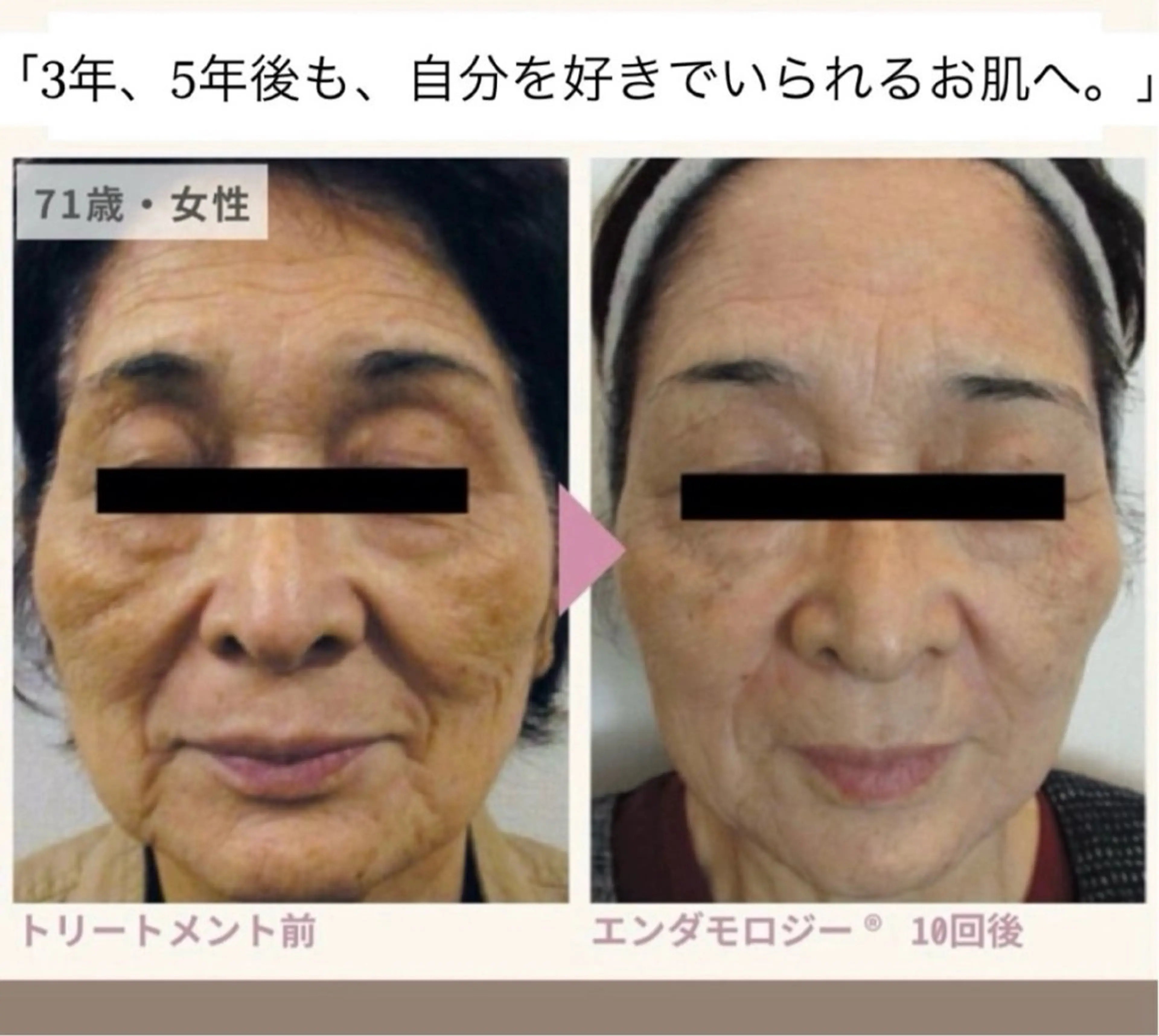 エステ Binosu所属・エンダモロジー BINOSUのエステ・リラクイメージ