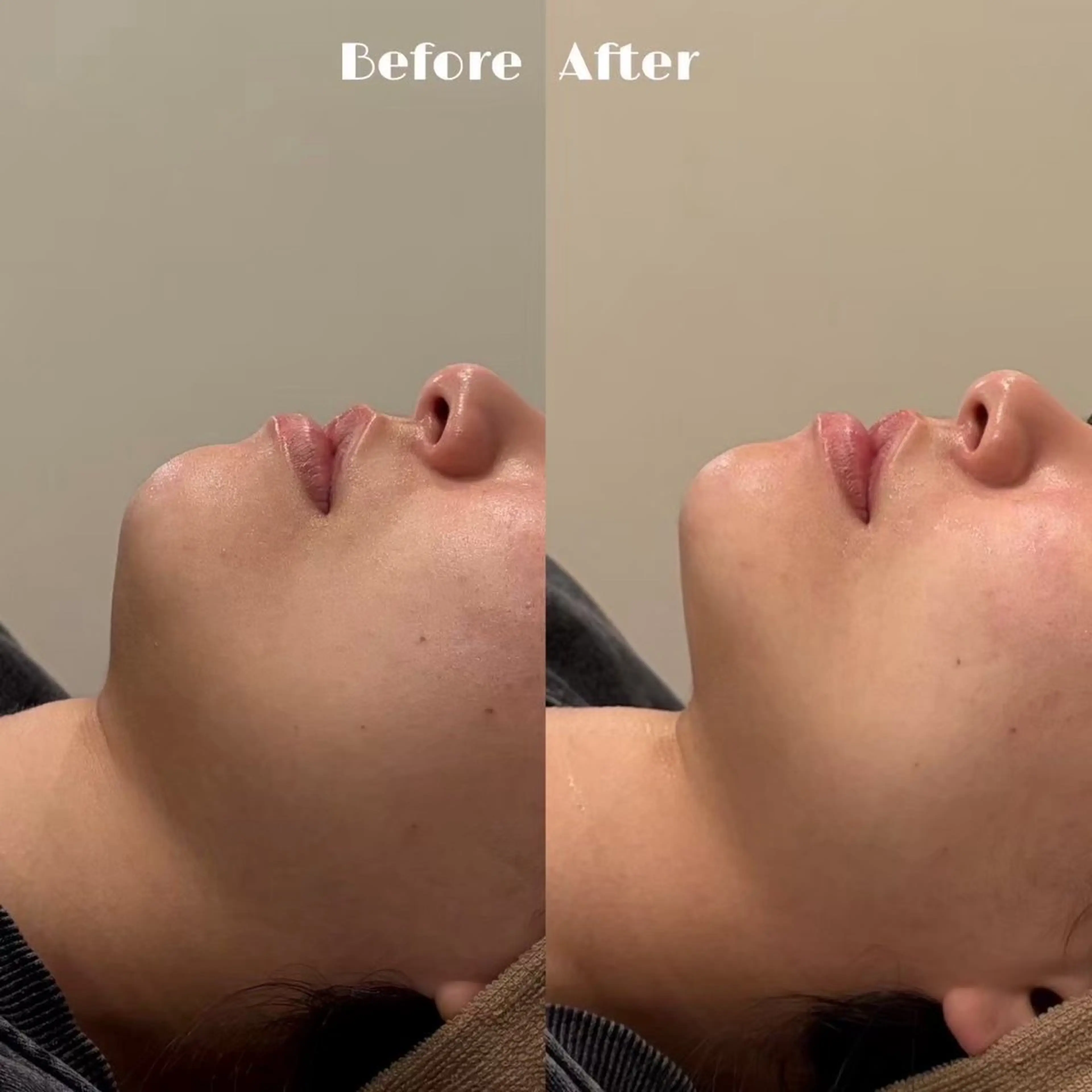 # fu♡のエステ・リラクイメージ