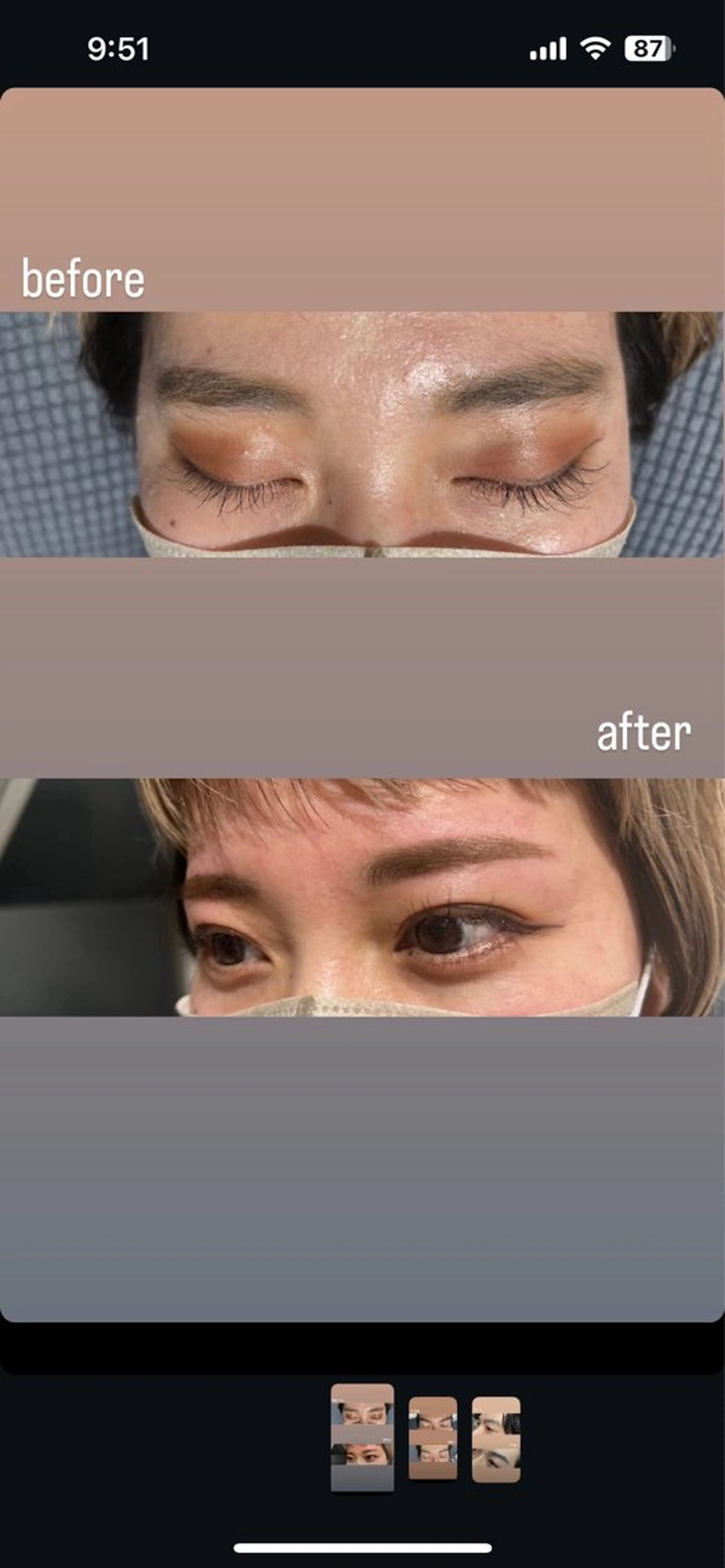 🐺期間限定🐺メンズまゆげワックス脱毛🌟🌟の写真