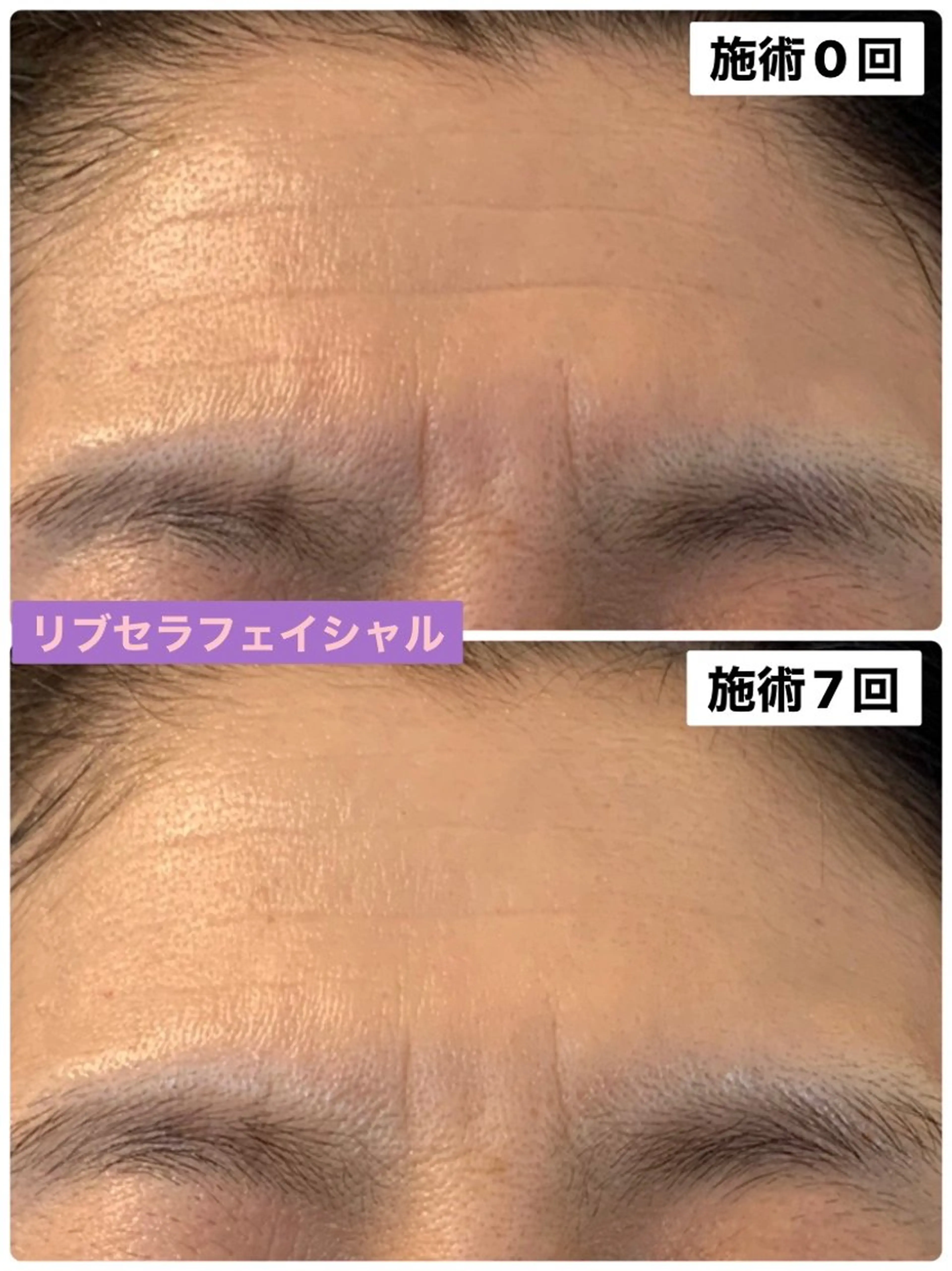 エステ プライベートサロン プリュネルのエステ・リラクイメージ