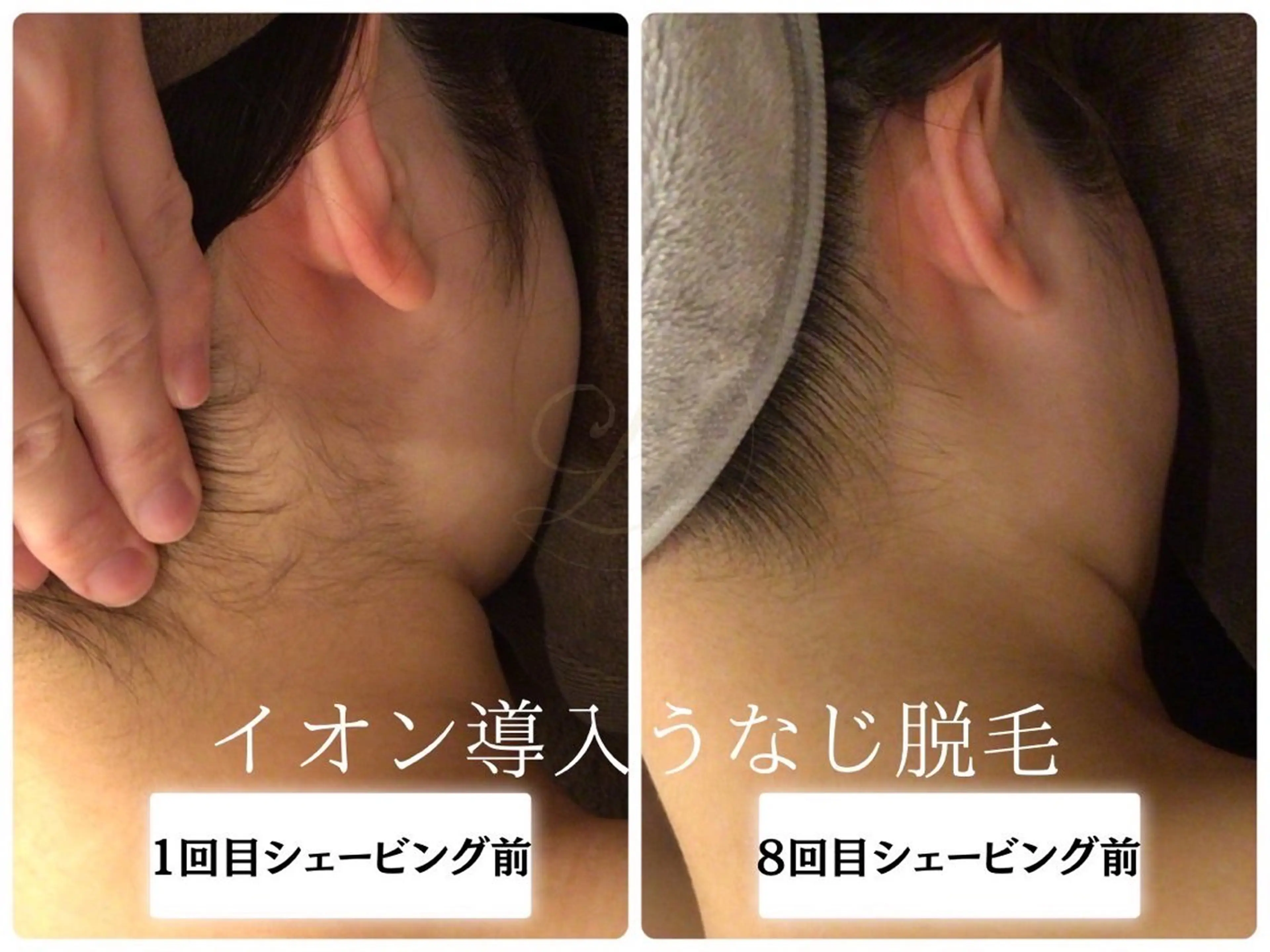 脱毛 🎀うなじ脱毛🎀 ㅣLino堀江のエステ・リラクイメージ