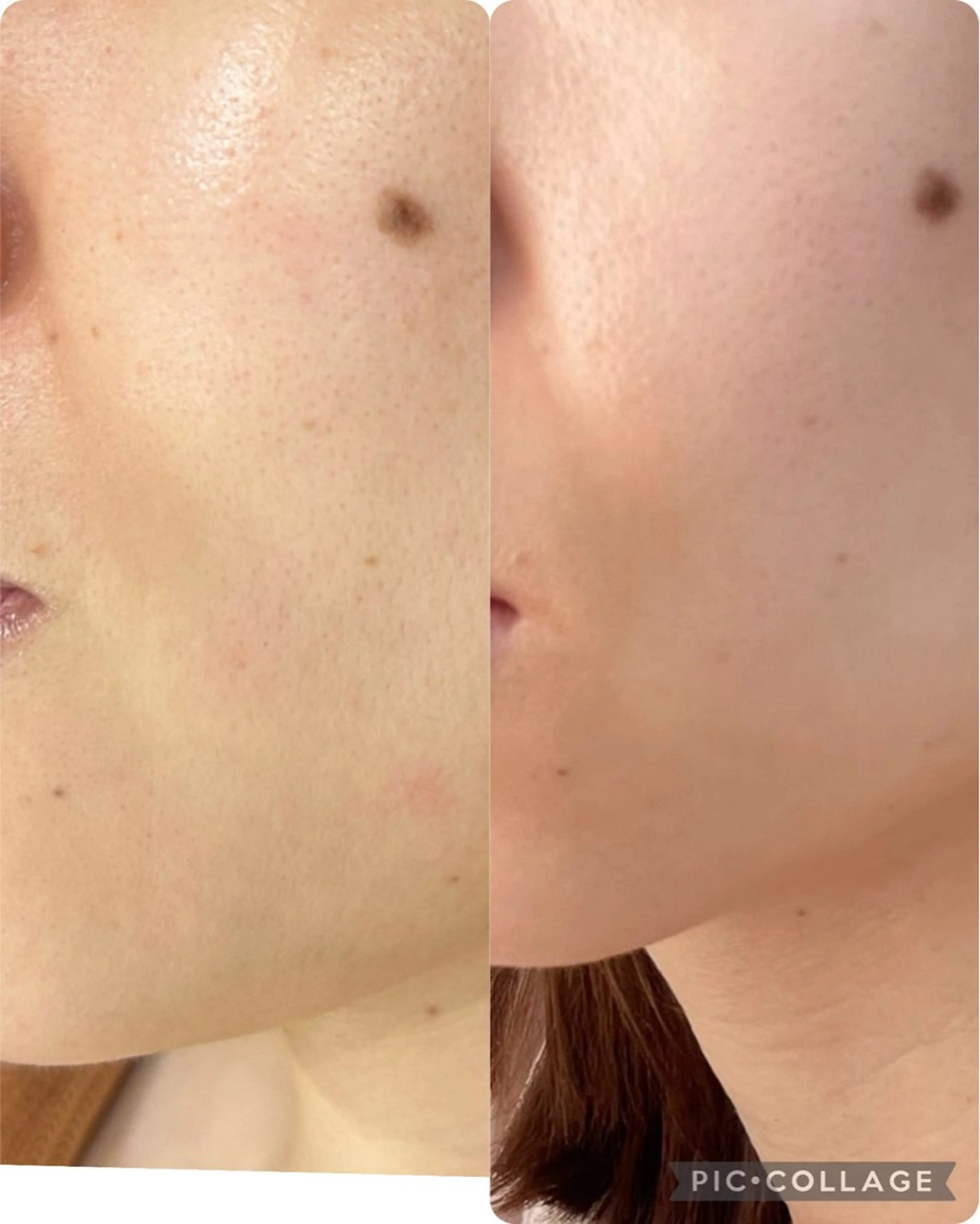 エステ indiba soleilのエステ・リラクイメージ