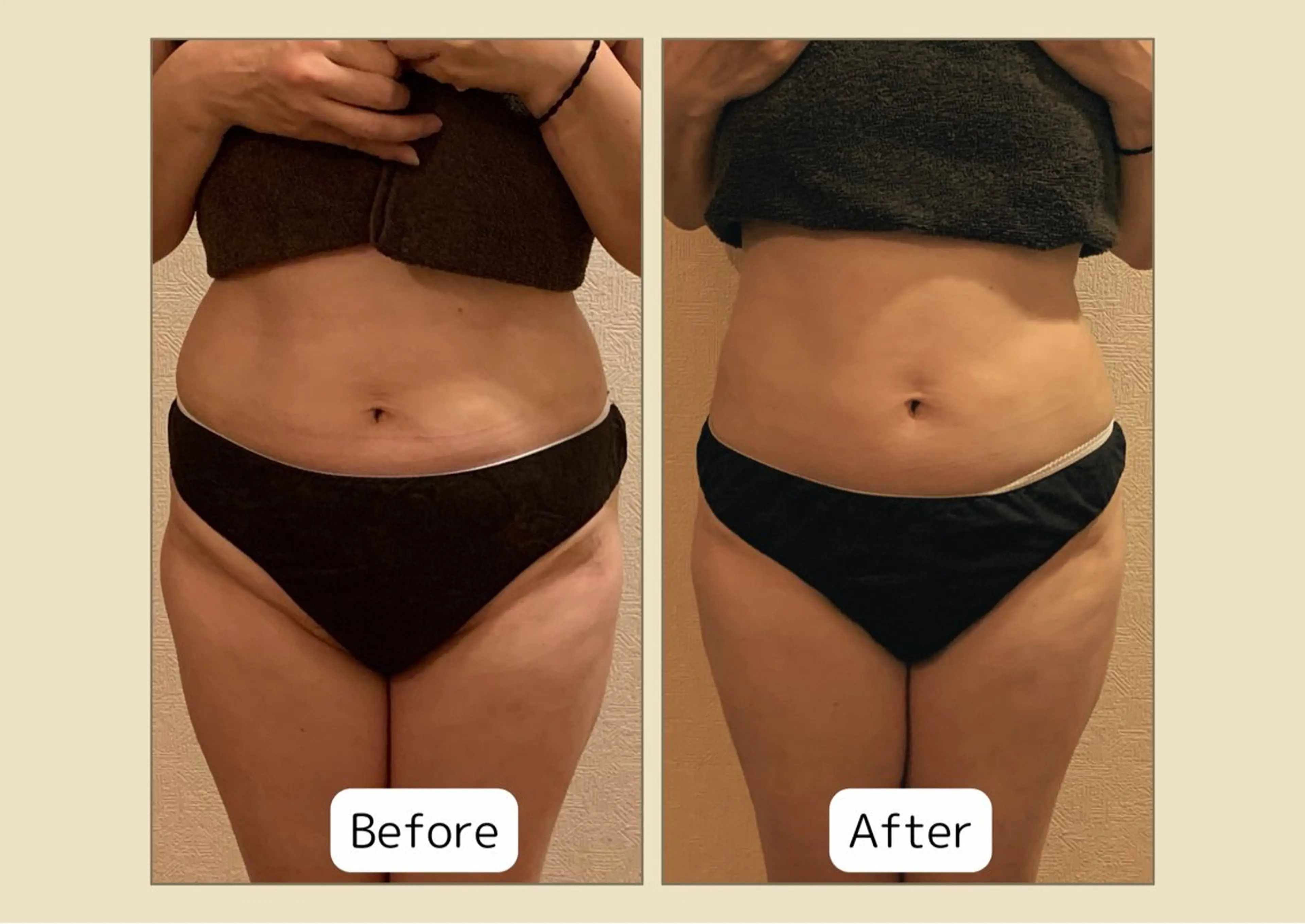 エステ リラク 温活痩身専門店 ヨサパークミリューのエステ・リラクイメージ