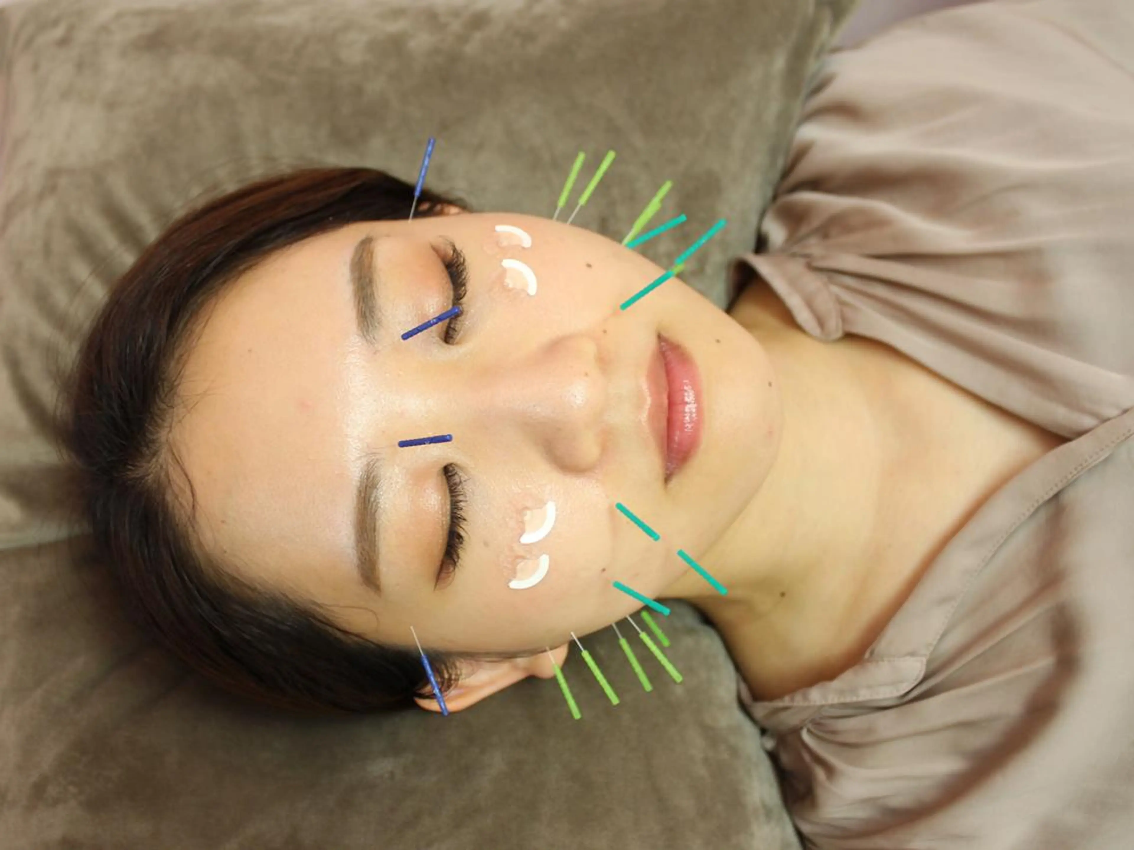 エステ リラク 同心整骨院 美容鍼・整体・小顔のエステ・リラクイメージ