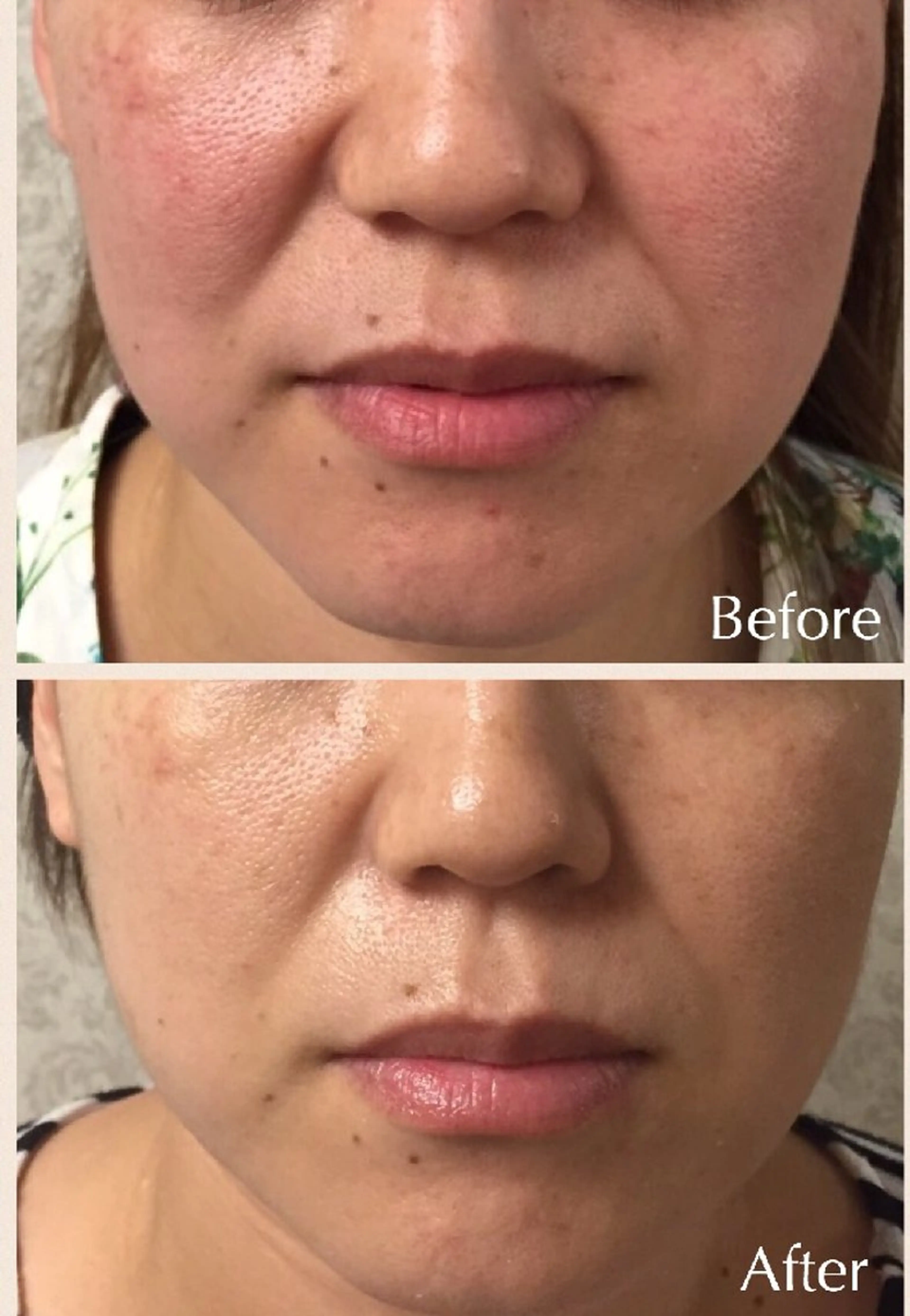 《乾燥肌ケア》エンビロン・モイスチャーブーストコース💙モニター募集の写真